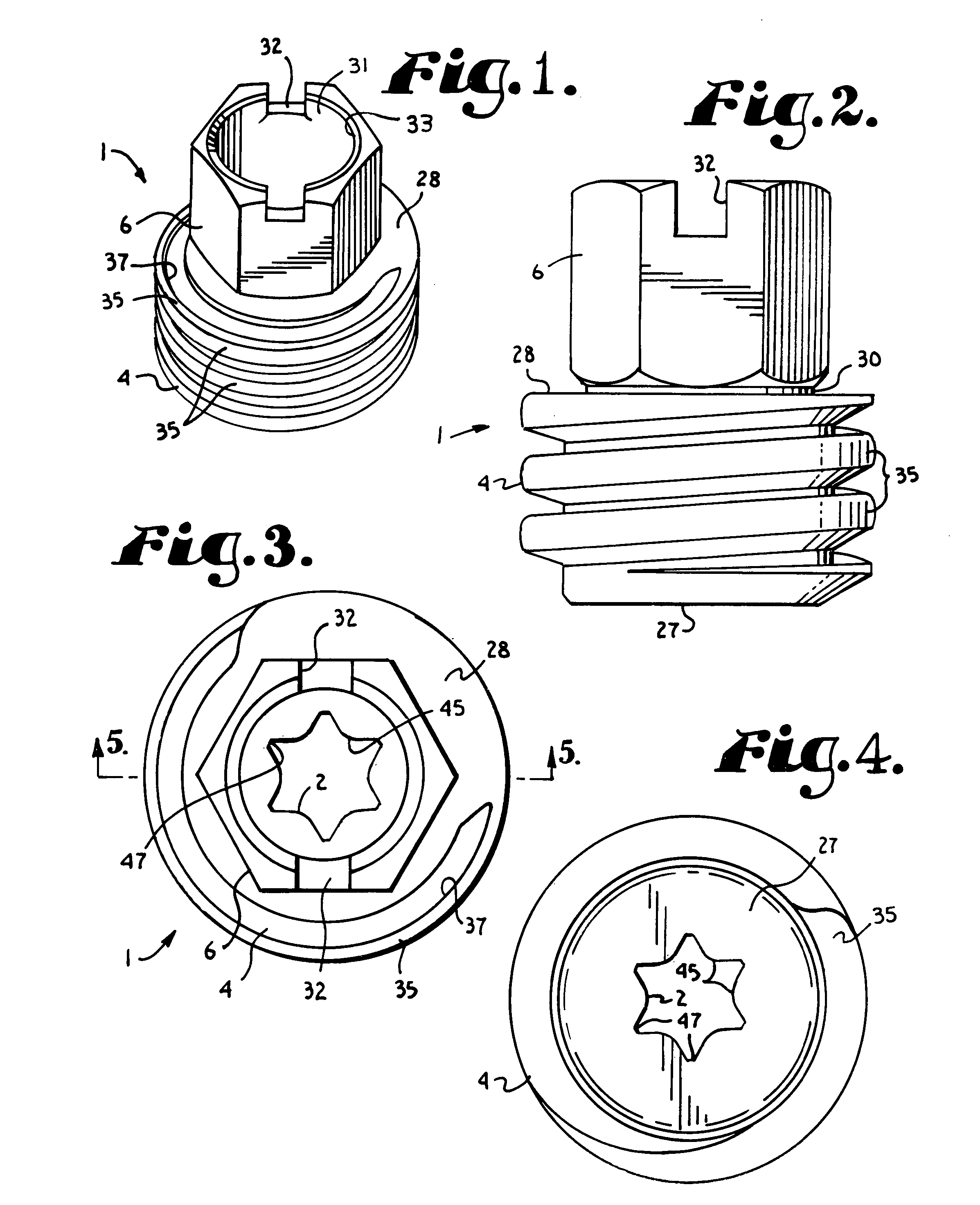 Anti-splay medical implant closure with multi-surface removal aperture