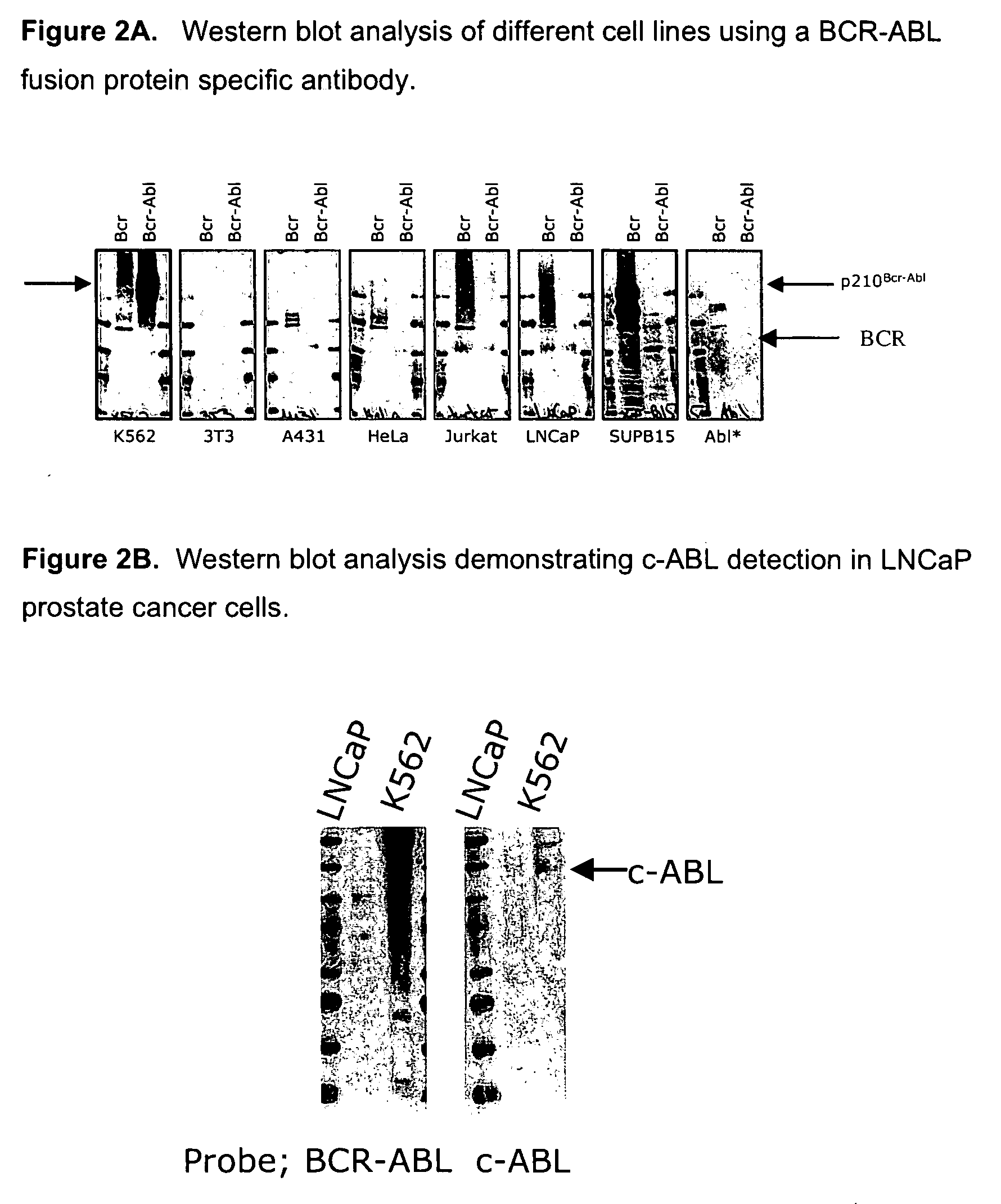 Antibodies specific for BCR-ABL fusion protein and uses thereof