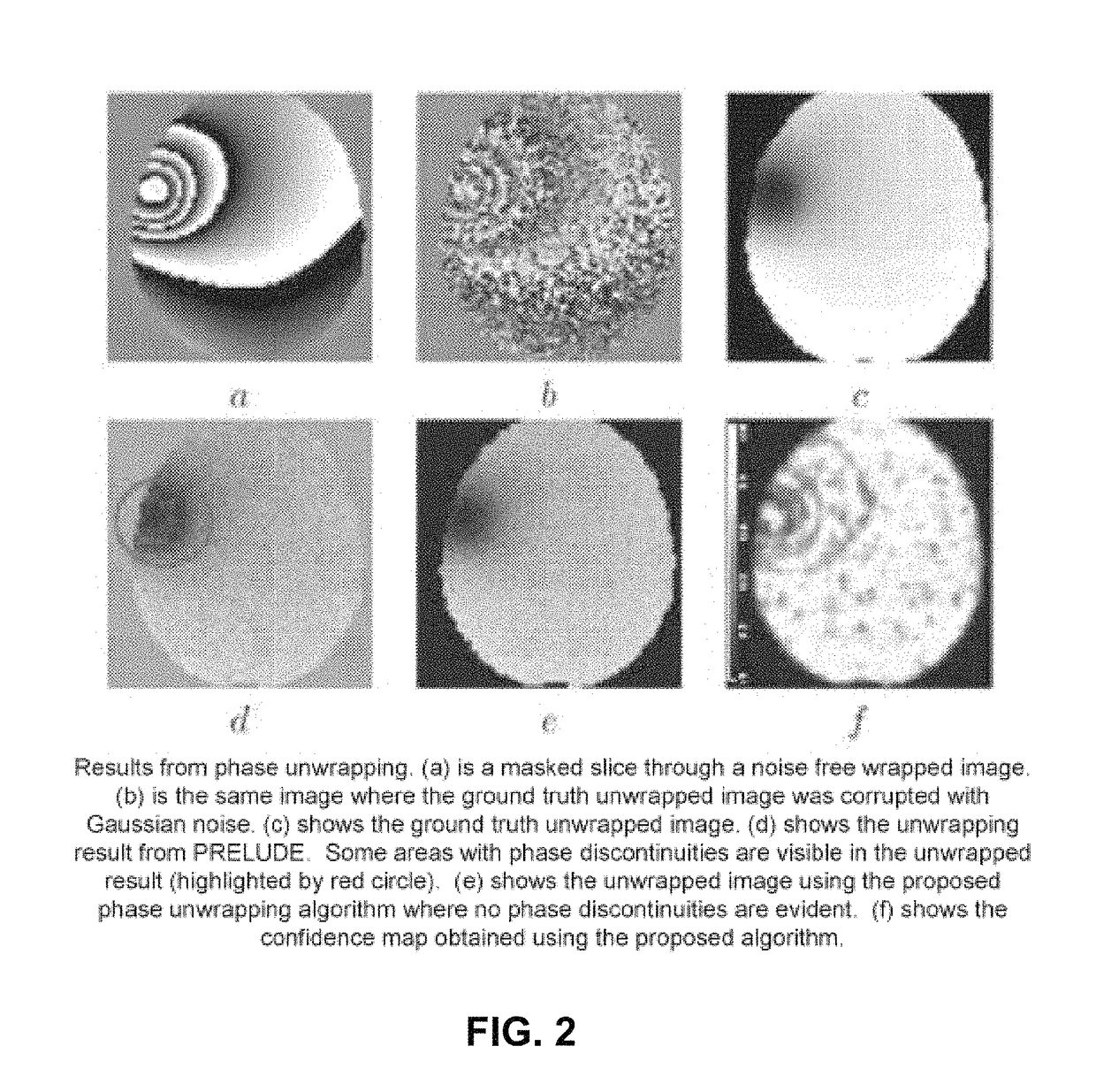 Apparatus and method for correcting susceptibility artefacts in a magnetic resonance image