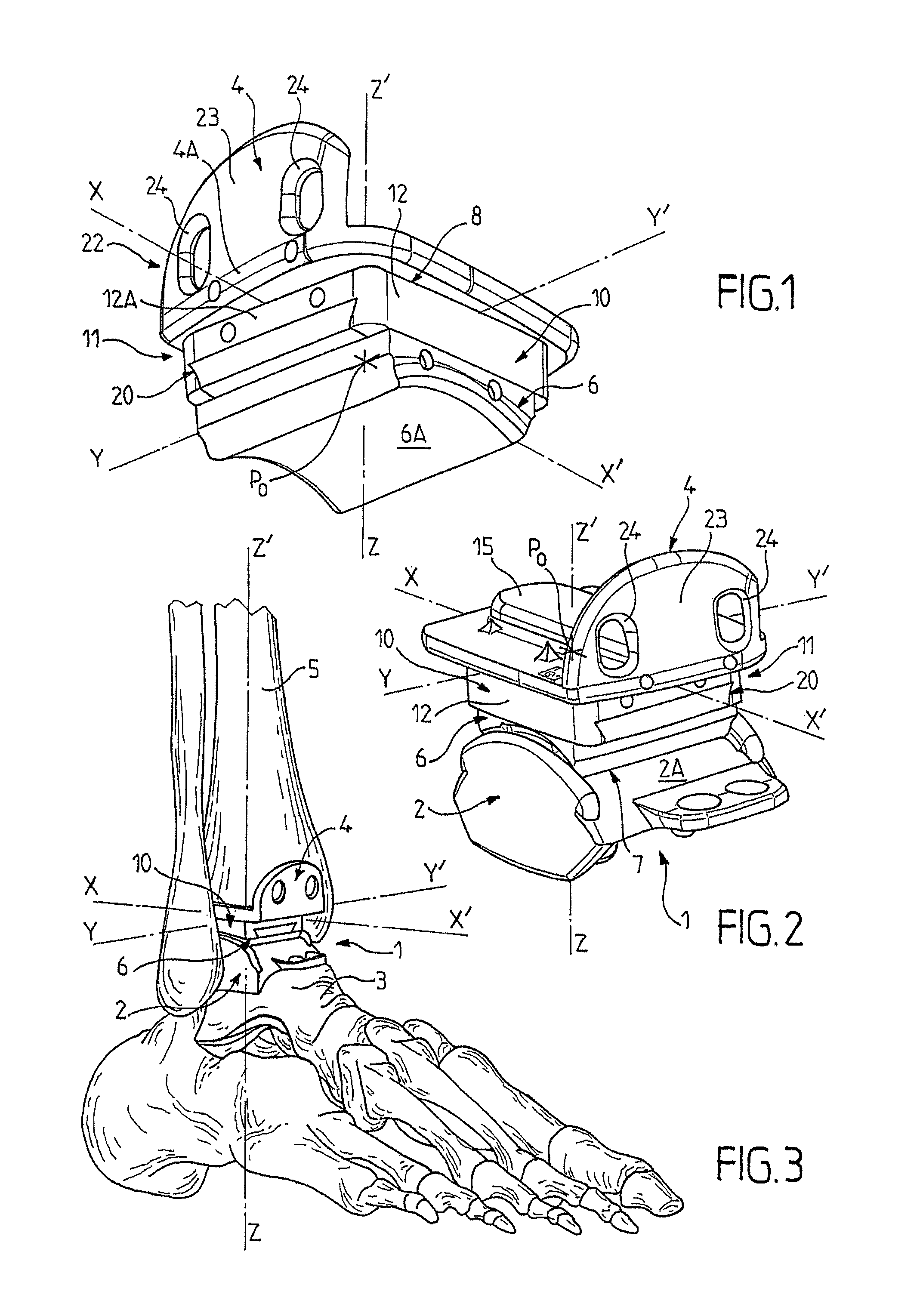 Ankle prosthesis with neutral position adjustment