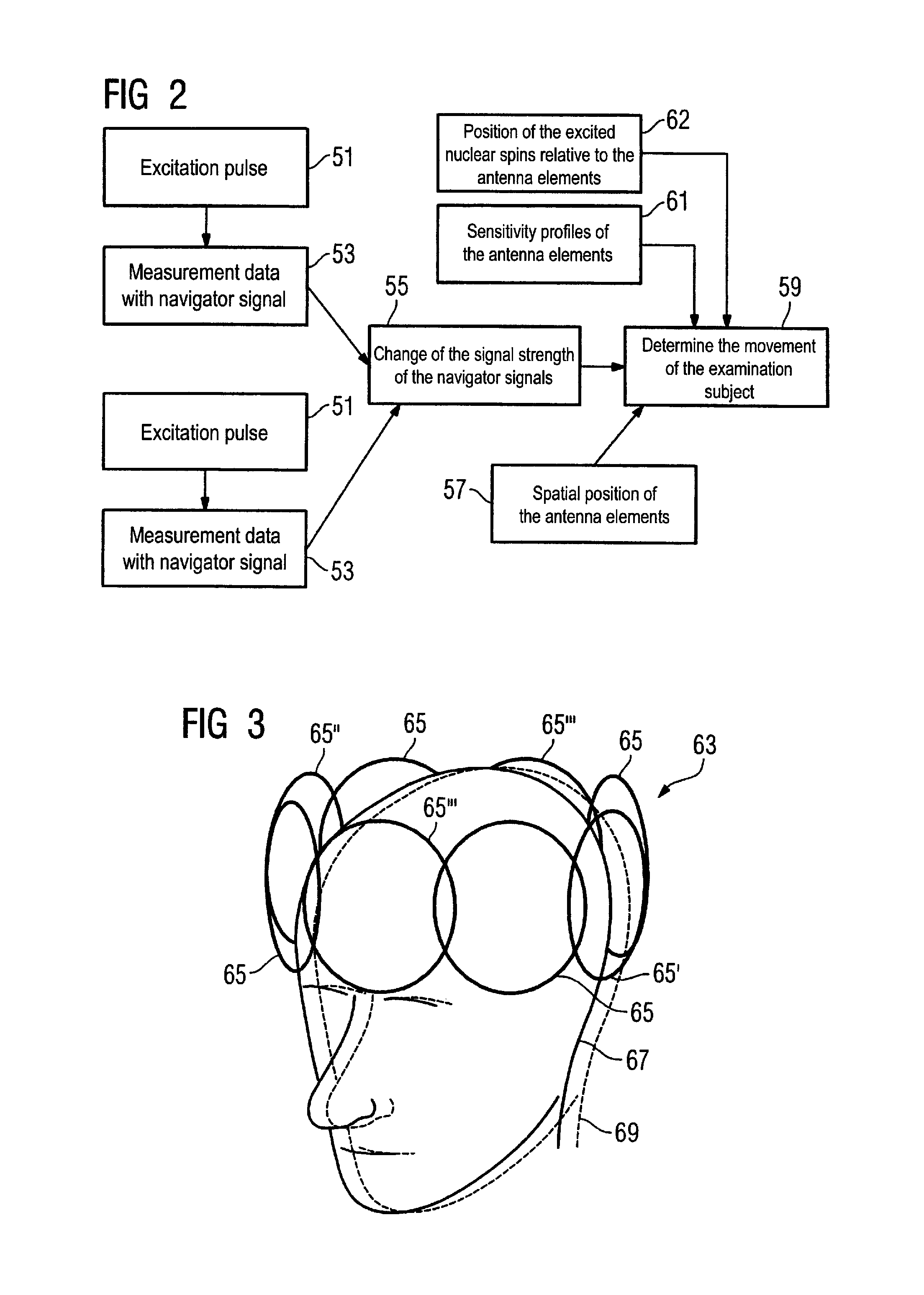Method and magnetic resonance apparatus for determination of patient movement during data acquisition