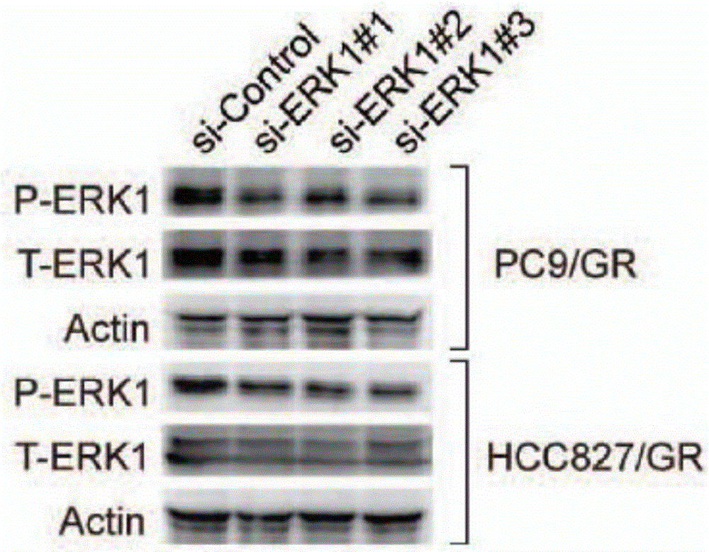 Application of ERK micro-molecular inhibitor in inhibition of drug-resistant lung cancer cells