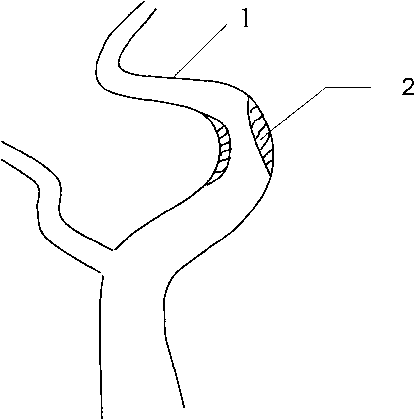 Self-expanded stent