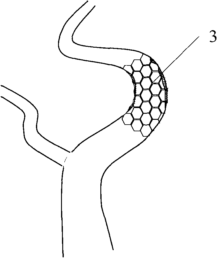 Self-expanded stent