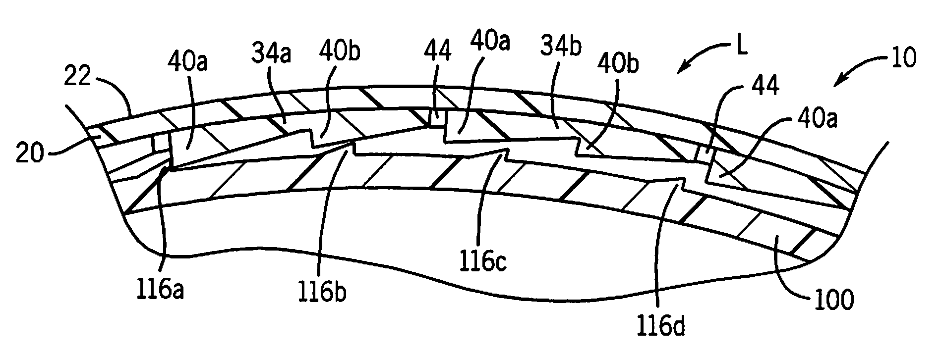 Container closure assembly