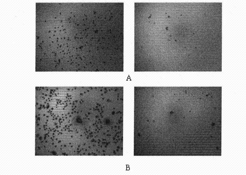 Use of piperlongumine derivatives in preparation of medicines for treating cancers and medicinal compositions thereof