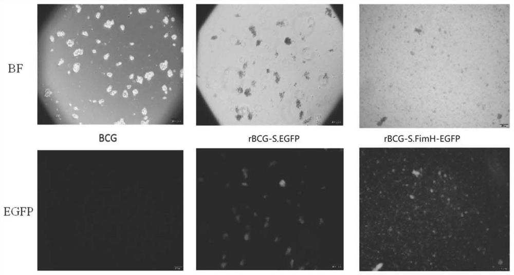 Recombinant BCG and its preparation method and application