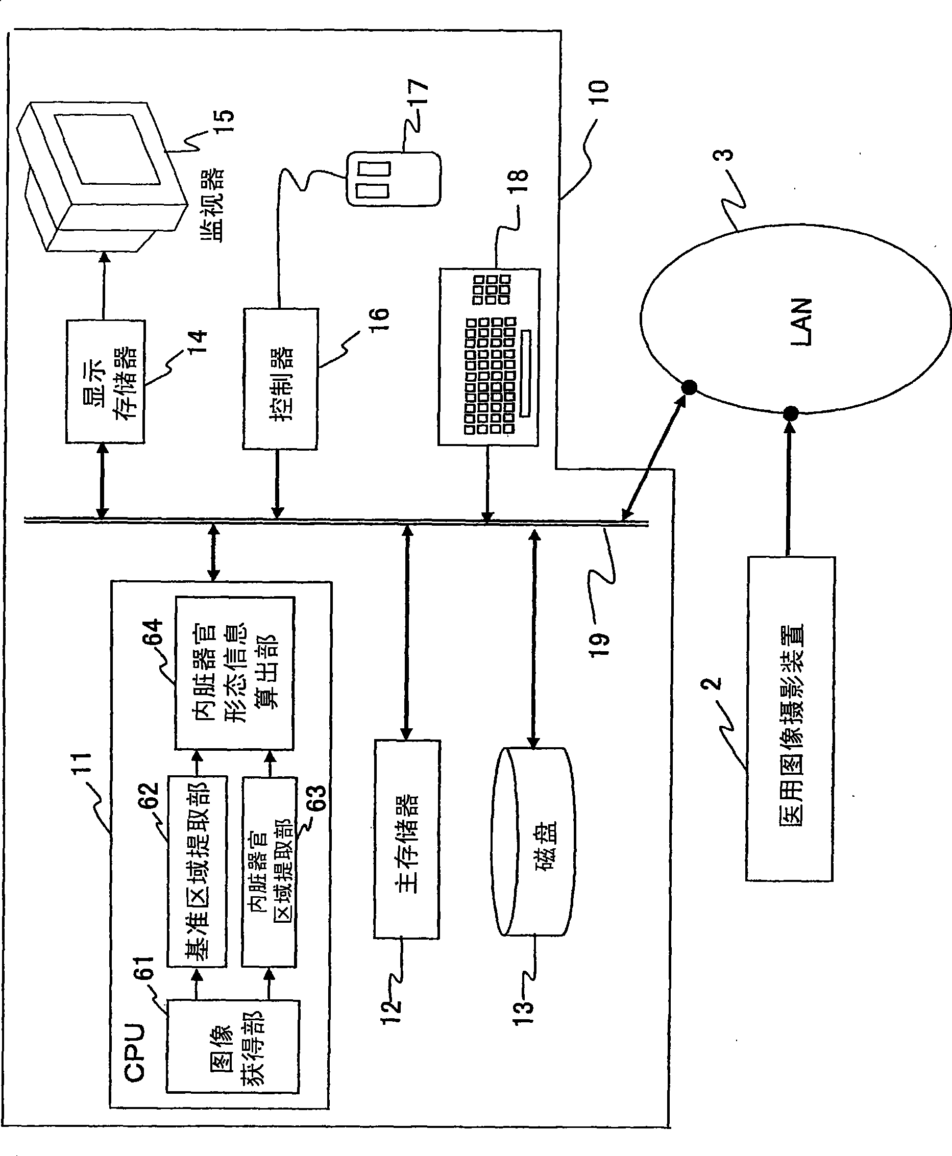 Image diagnosis support device and image diagnosis support program