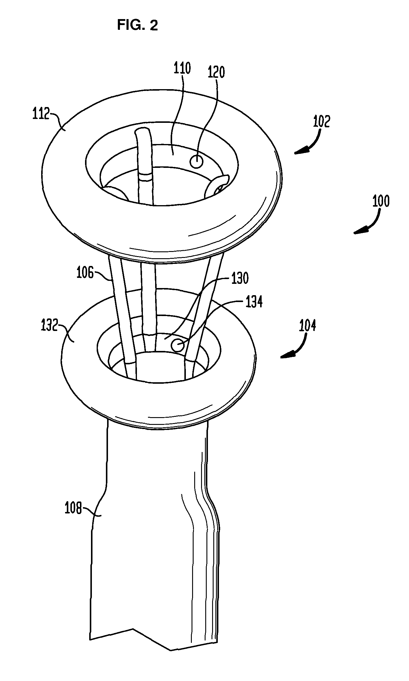 Systems and methods for treating obesity and type 2 diabetes