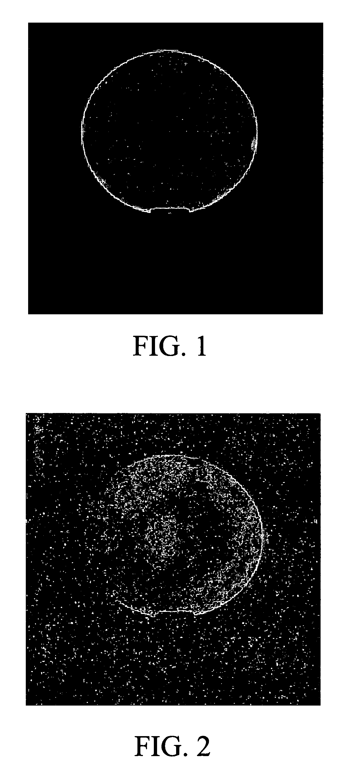 Method and apparatus for serial array excitation for high field magnetic resonance imaging