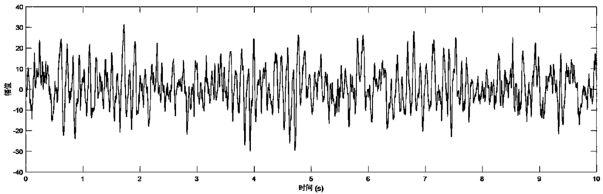 Method for eliminating myoelectric artifact in single-channel electroencephalogram signal