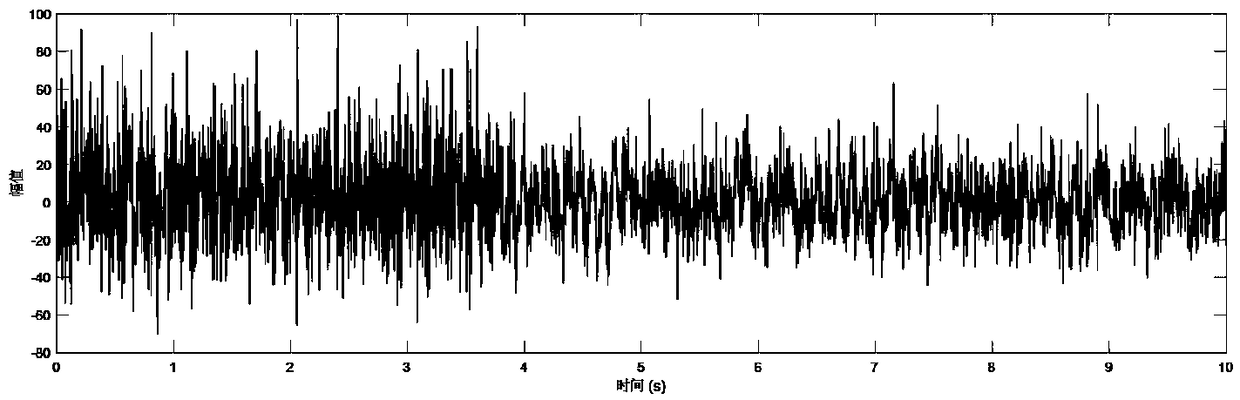 Method for eliminating myoelectric artifact in single-channel electroencephalogram signal