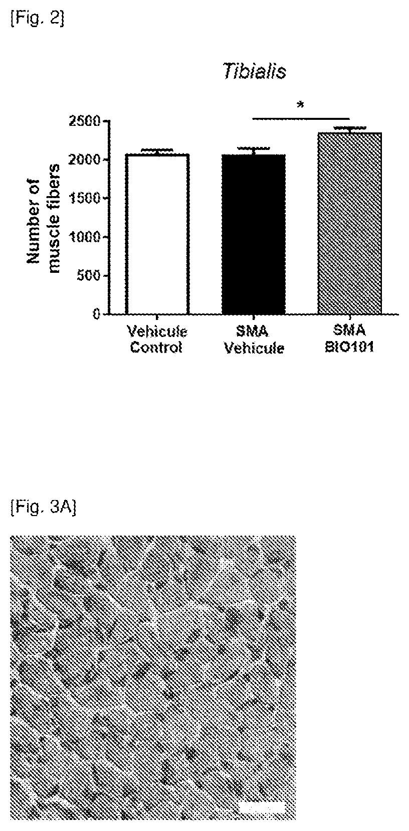Phytoecdysones and the derivatives thereof for use in the treatment of neuromuscular diseases
