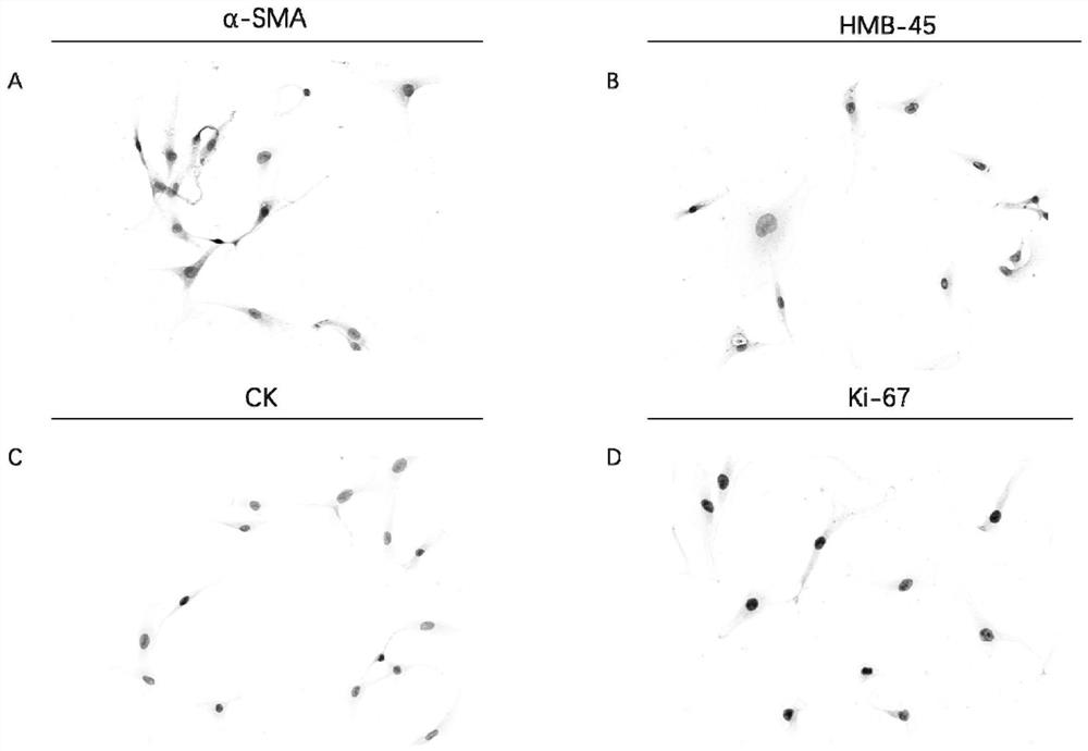 Human renal vascular smooth muscle lipoma primary cell, human renal vascular smooth muscle lipoma progeny cell and applications thereof