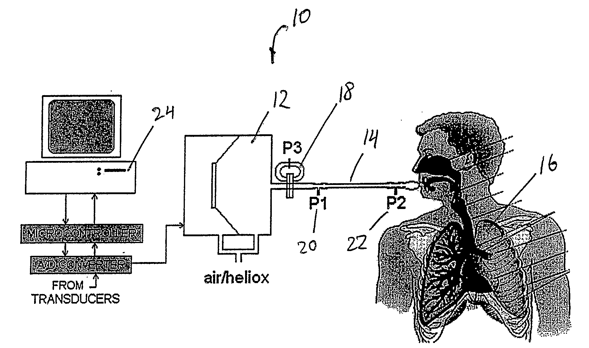 Method of measuring an acoustic impedance of a respiratory system and diagnosing a respiratory disease or disorder or monitoring treatment of same