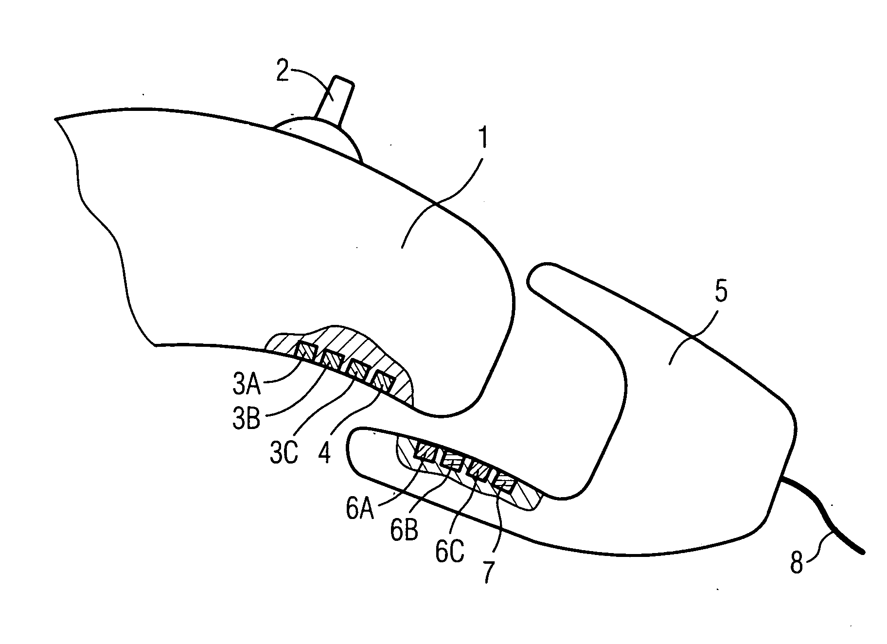 Interface facility for signal transmission between a hearing aid device and an external device