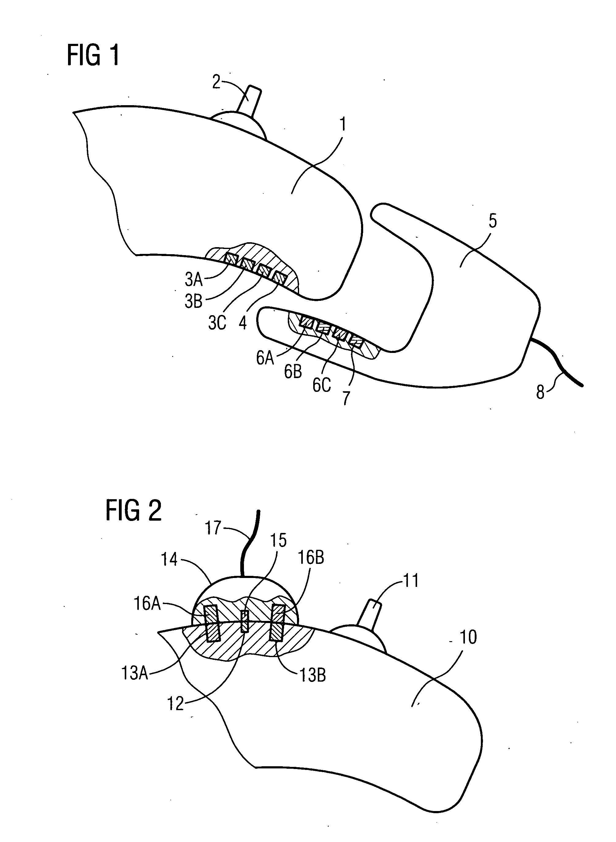 Interface facility for signal transmission between a hearing aid device and an external device