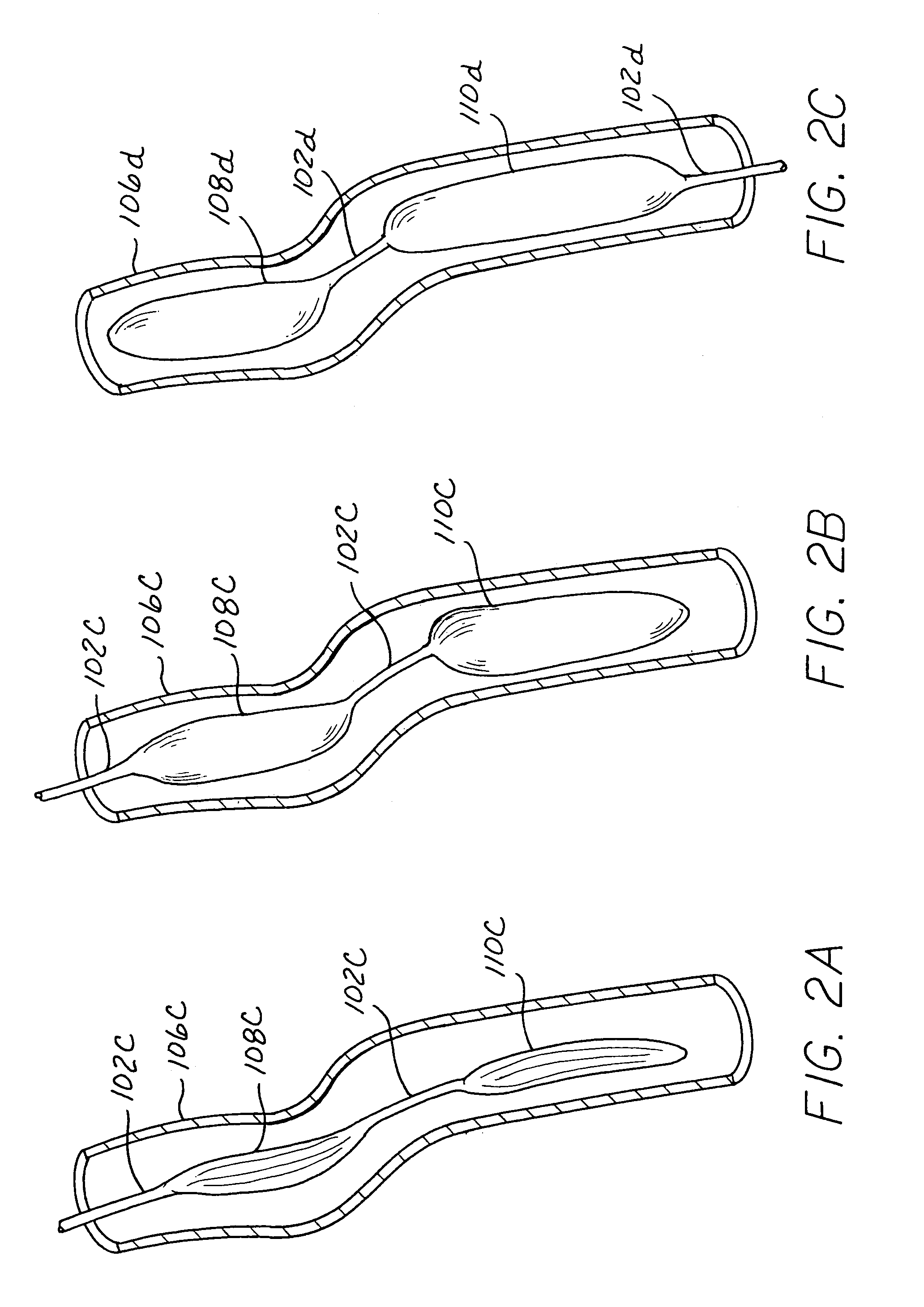 Long term ambulatory intra-aortic balloon pump with three dimensional tortuous shape