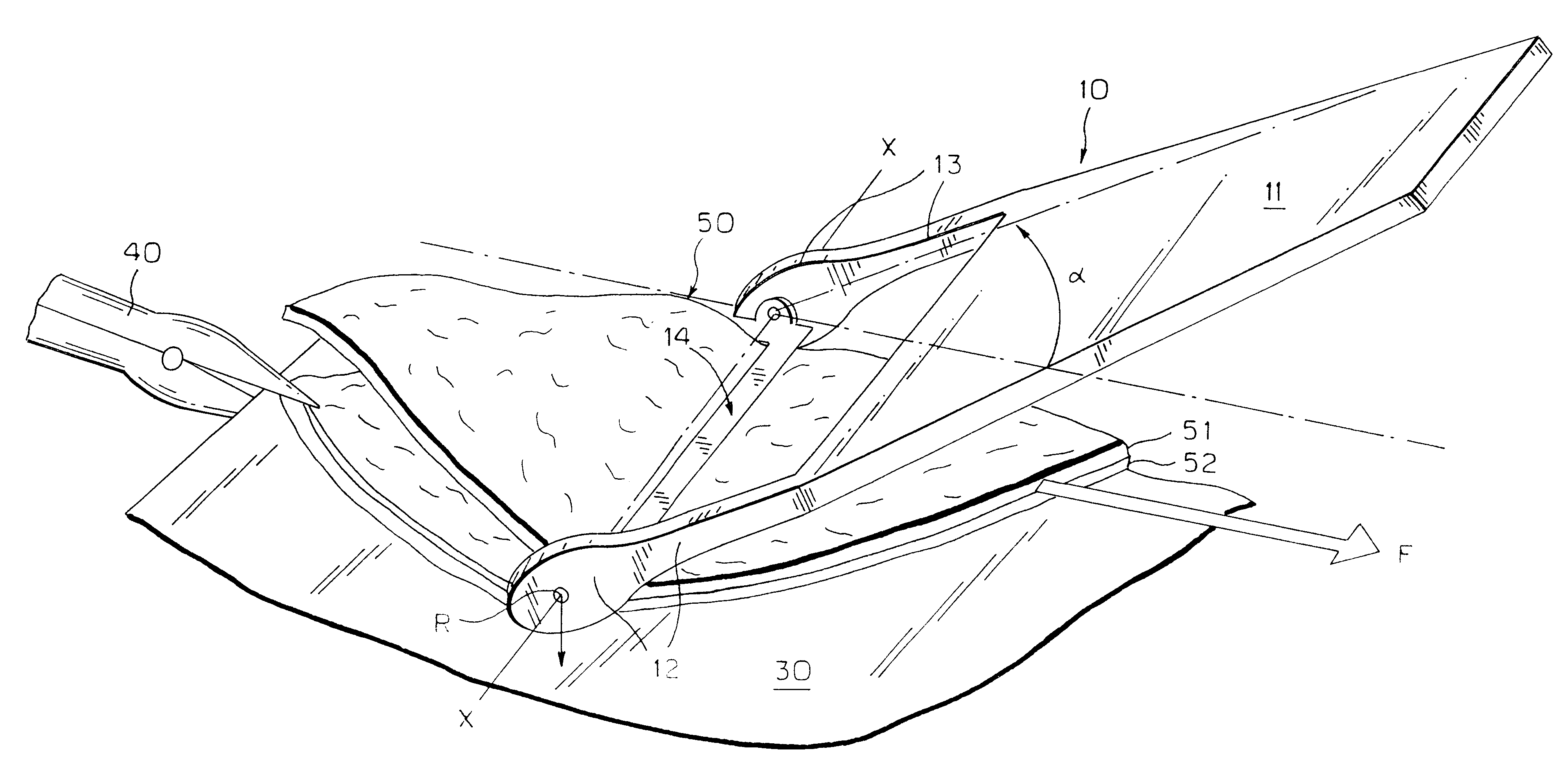 Hand-held device for preparation of a skin graft by tangential excision of layers of tissue