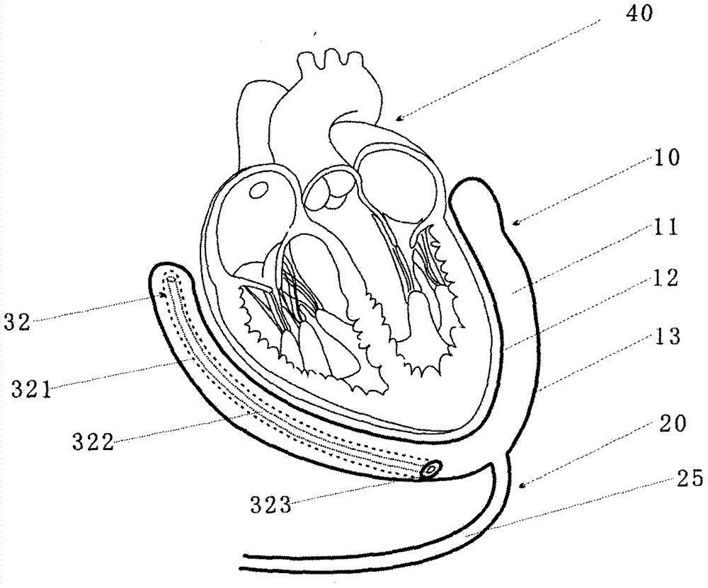 Pneumatic type balloon heart assisting apparatus