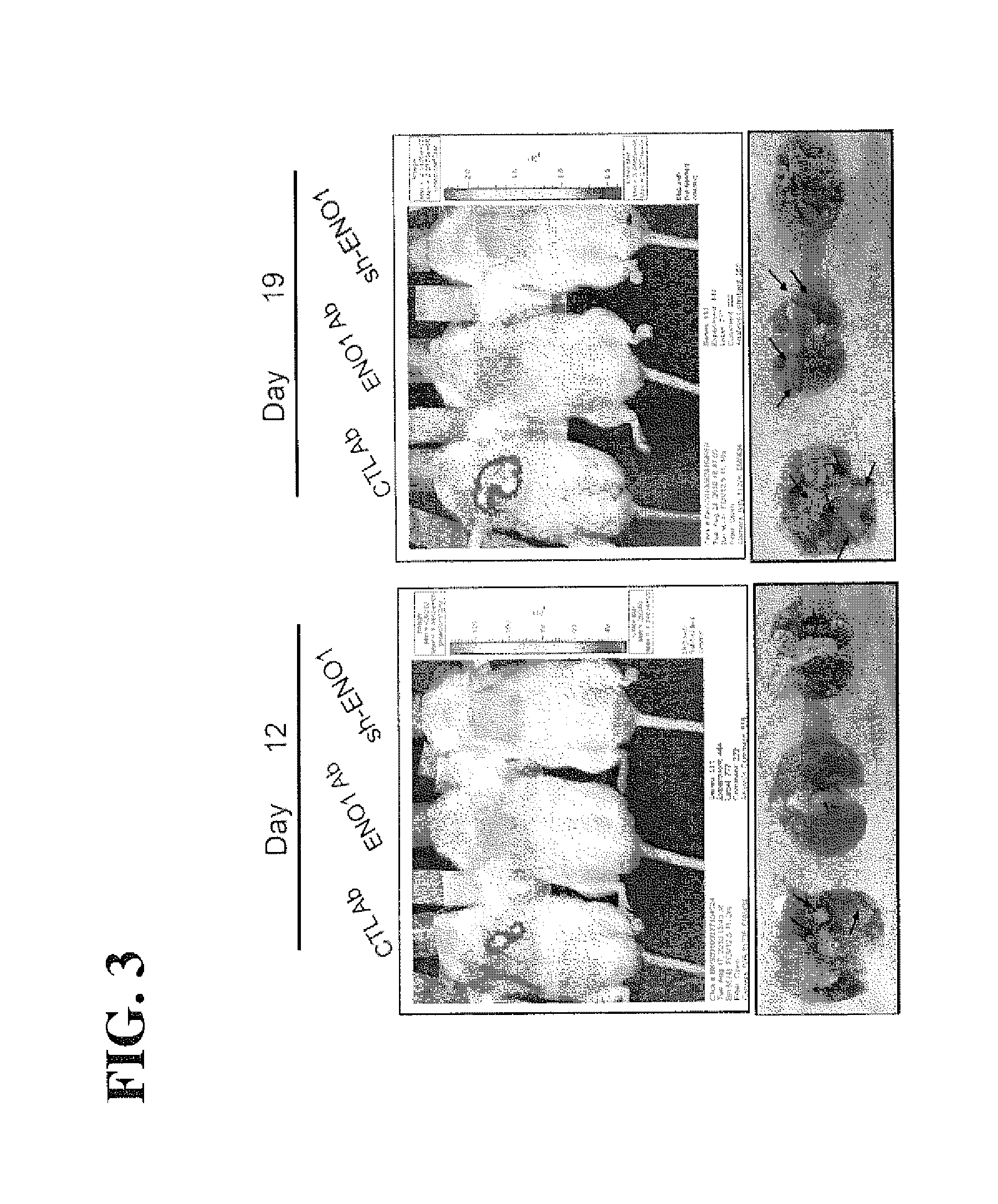 Alpha-enolase specific antibodies and methods of uses in cancer therapy