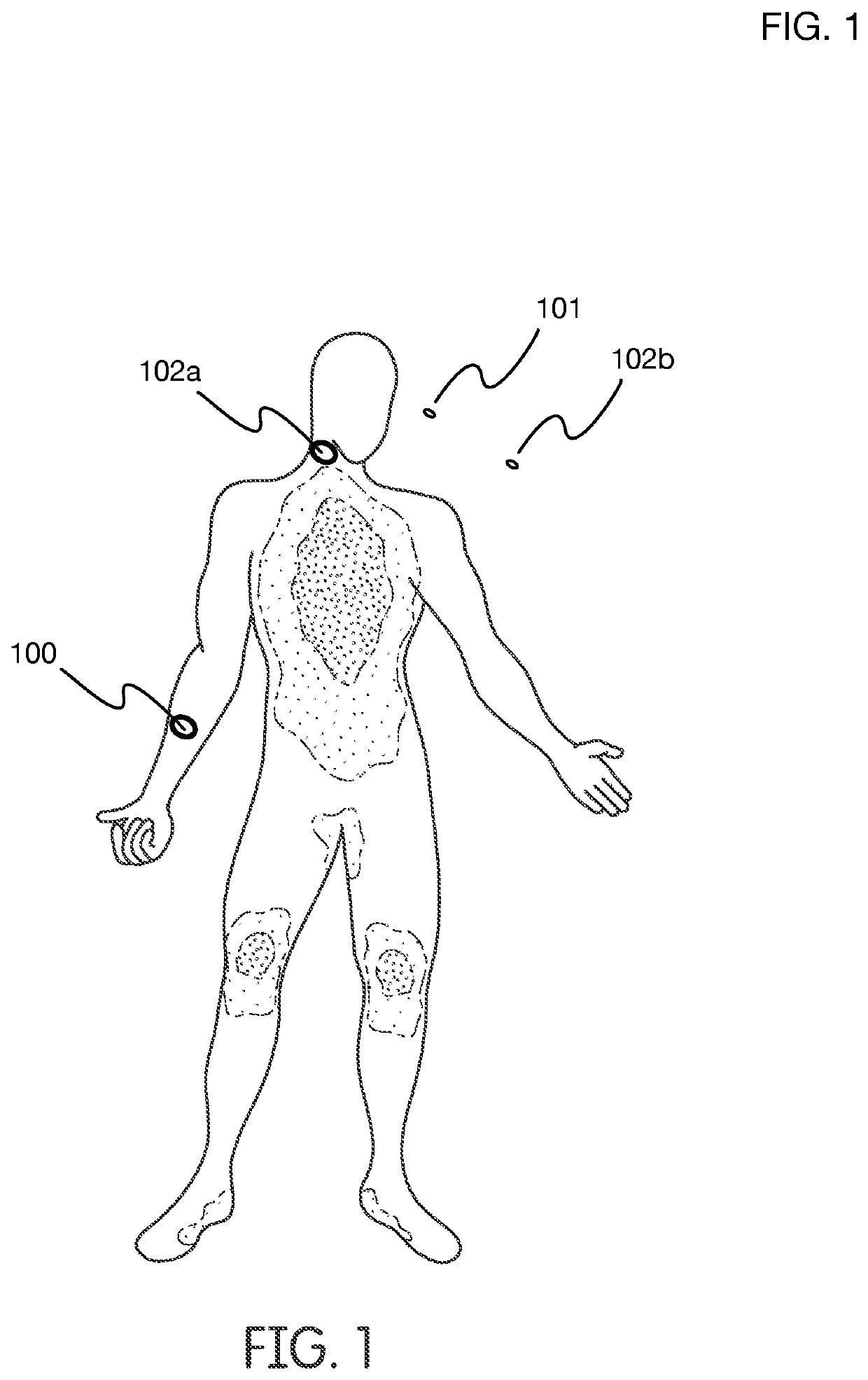 Wearable phototherapy apparatus with Anti-viral and other effects