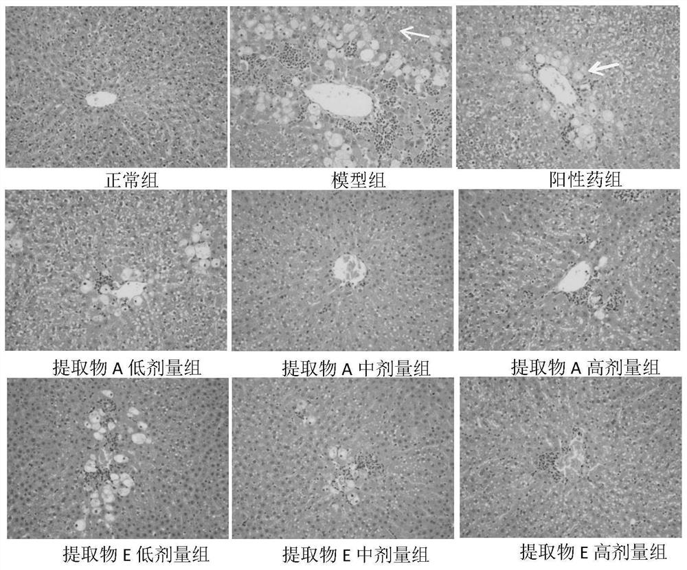 LE CAO SHI FANG extract and application thereof to liver protection