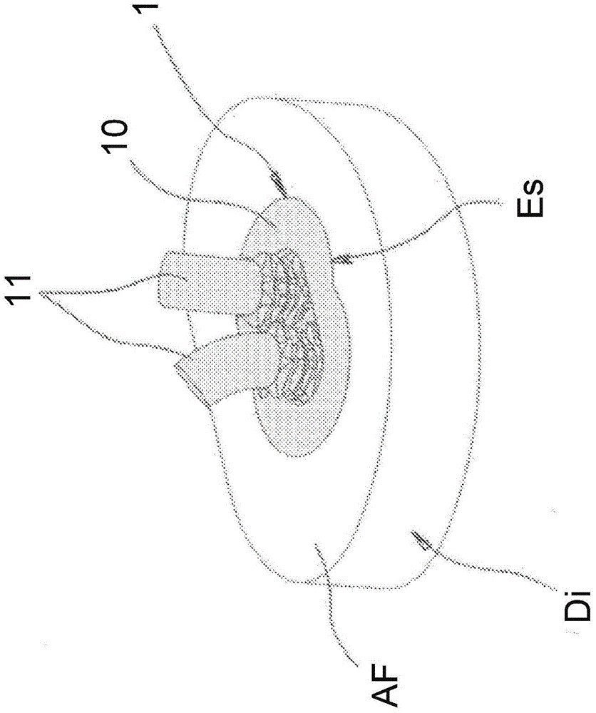 Improved Silicon Nucleus Implant