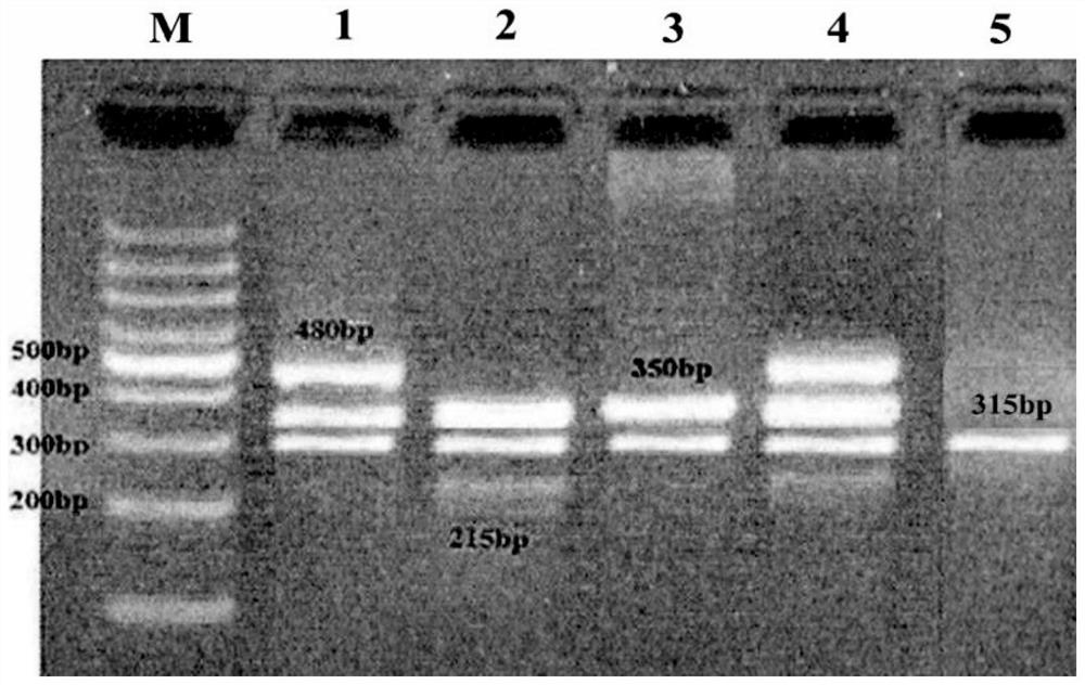 Primers, probes and fluorescent pcr kits for detecting ugt1a1 genotype and gst gene deletion type of neonatal jaundice