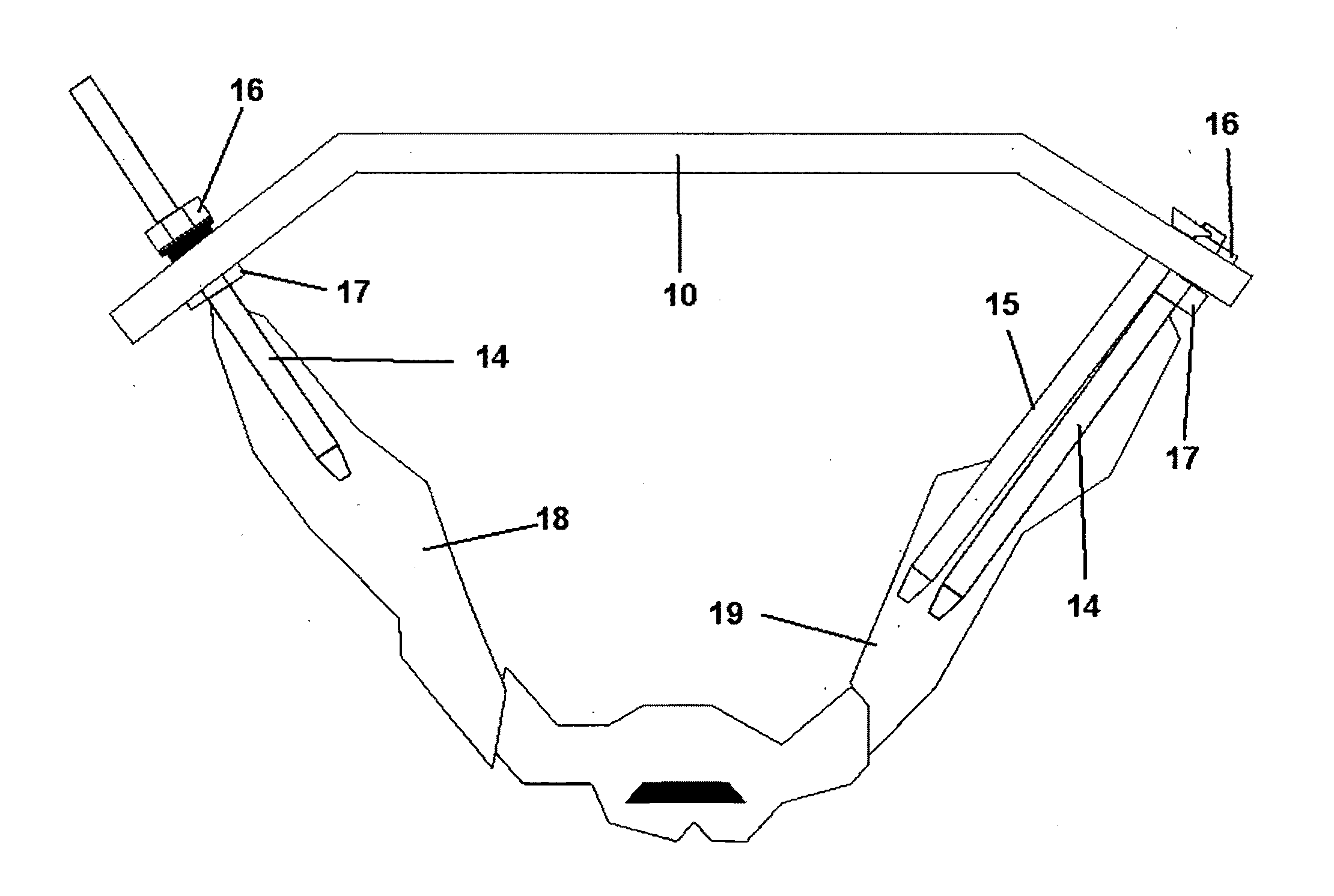 Method and apparatus for minimally invasive treatment of unstable pelvic ring injuries