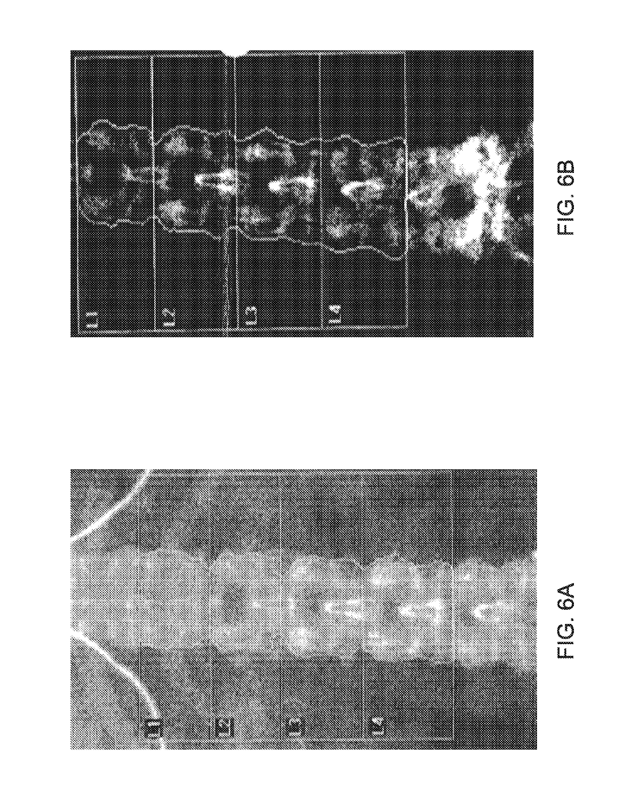 Methods and compositions for preventing and treating osteoporosis