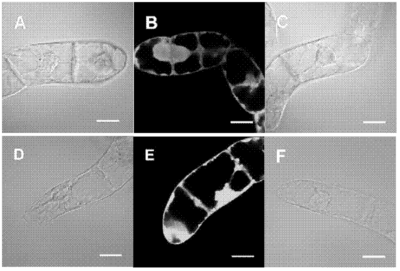 Immobilized modification method for plant suspension cells