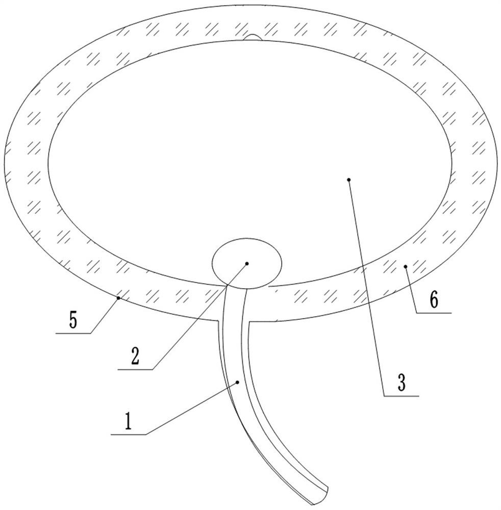 Auxiliary bladder perfusion device