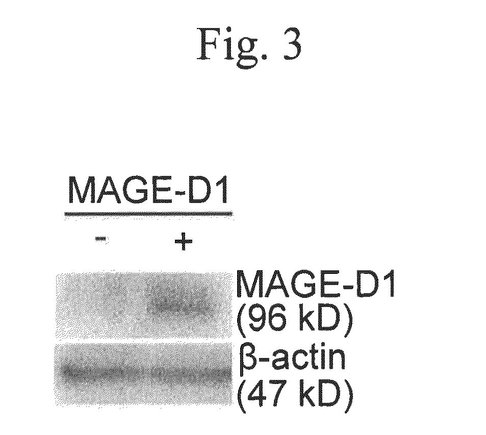 Method for determining depression, kit for analyzing serotonin transporter, and kit for analyzing ubiquitinated serotonin transporter in blood