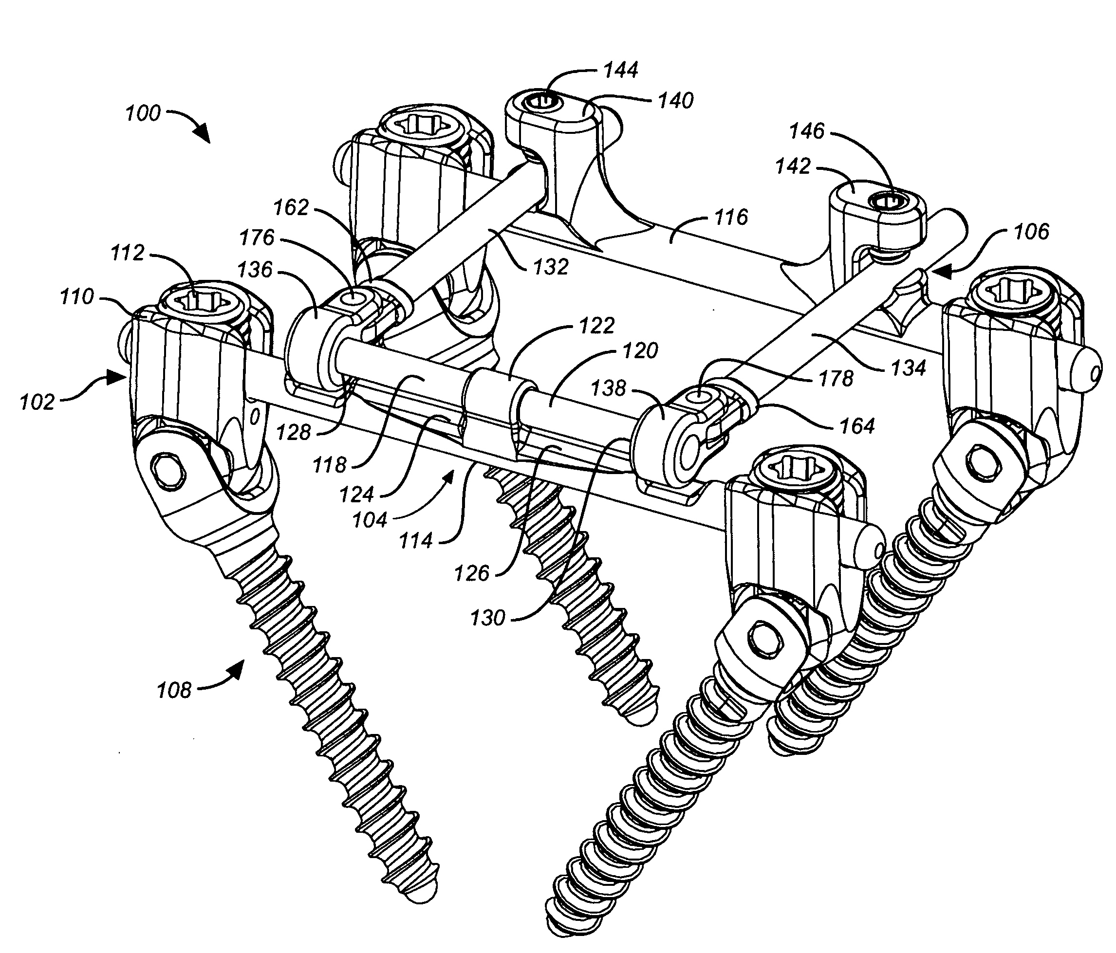 Dynamic stabilization and motion preservation spinal implantation system with a shielded deflection rod system and method