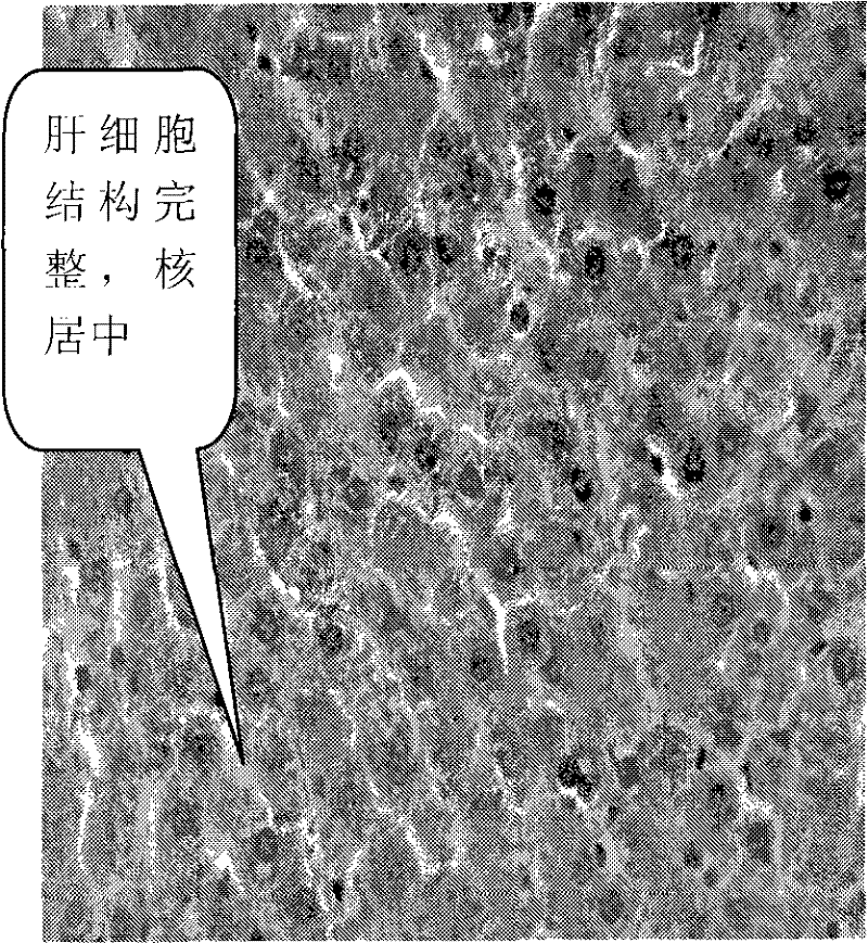 Gynostemma pentaphylla extract and preparation method thereof and use thereof in preparing medicine for preventing and treating fatty liver and sub-health
