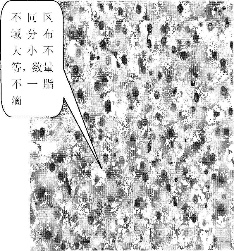 Gynostemma pentaphylla extract and preparation method thereof and use thereof in preparing medicine for preventing and treating fatty liver and sub-health
