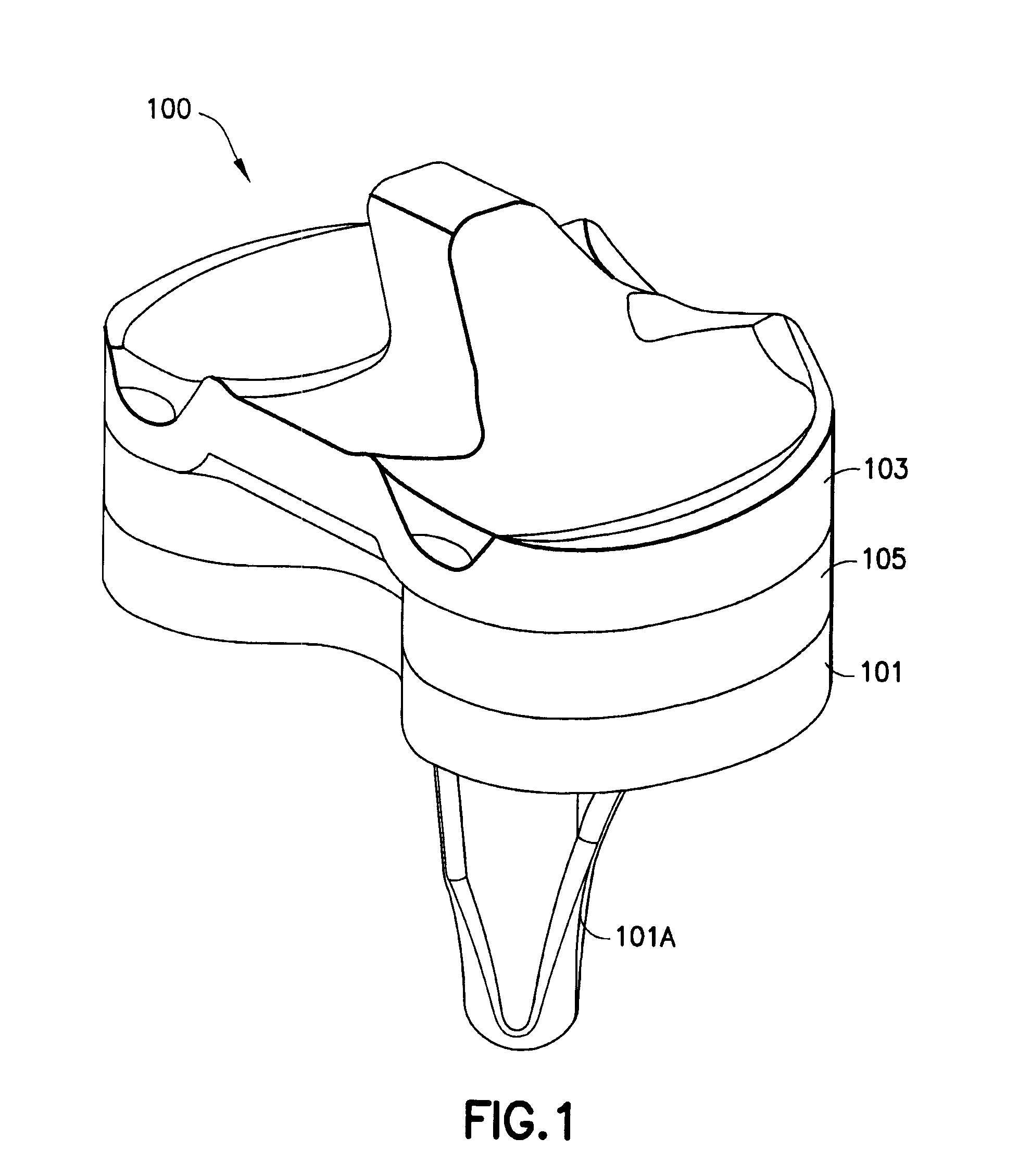 System and method for adjusting the thickness of a prosthesis