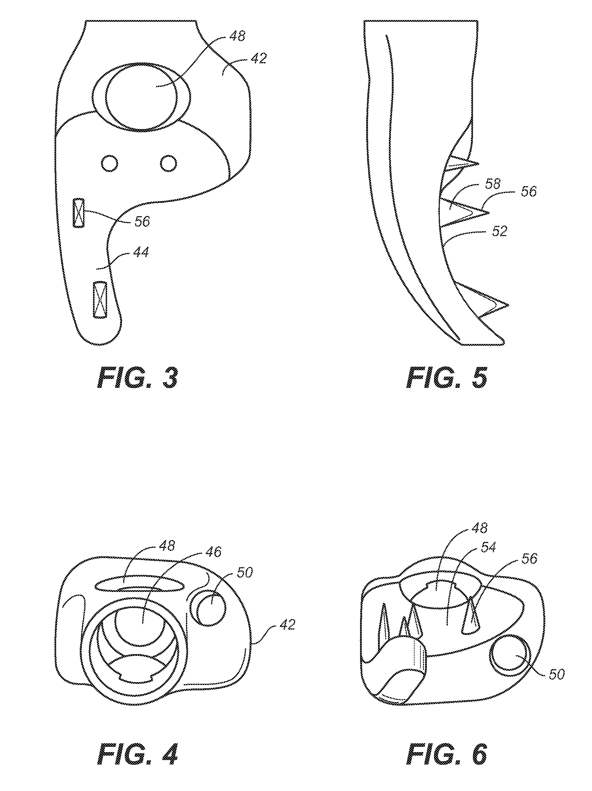 Implant system and method to treat degenerative disorders of the spine