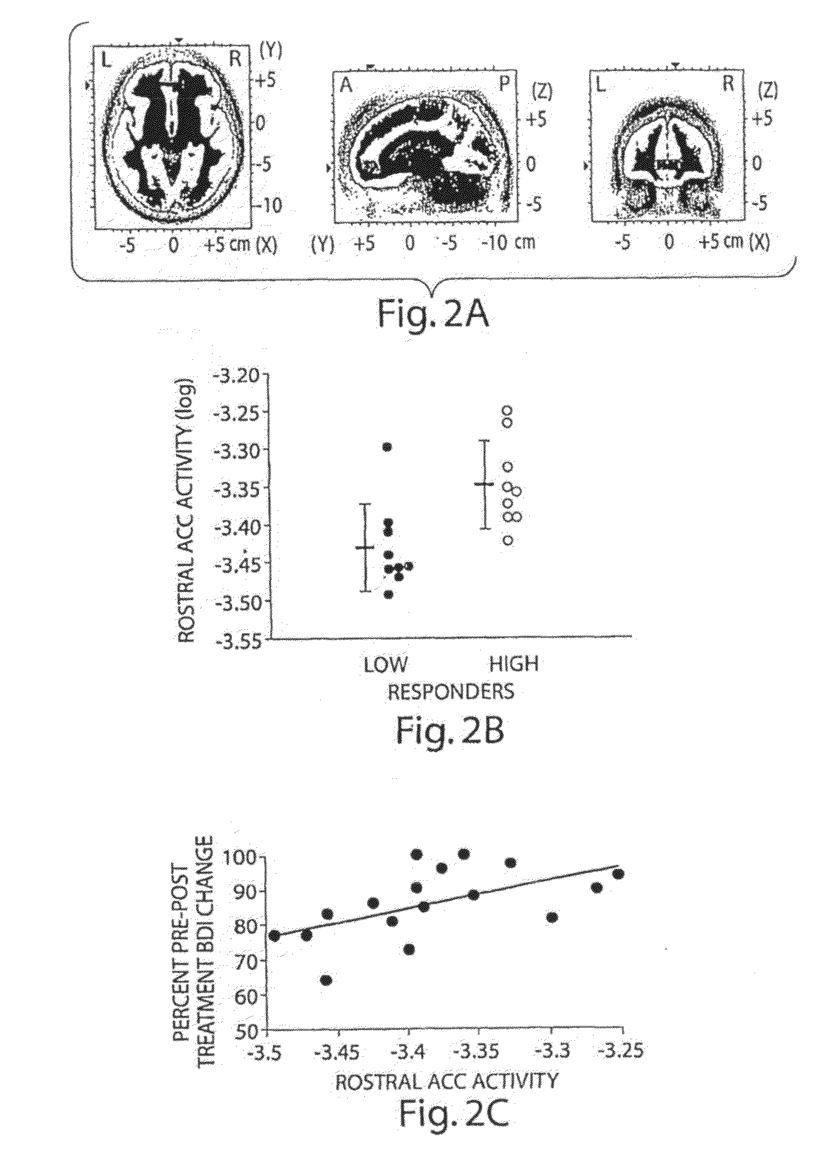 Systems and methods for predicting effectiveness in the treatment of psychiatric disorders, including depression