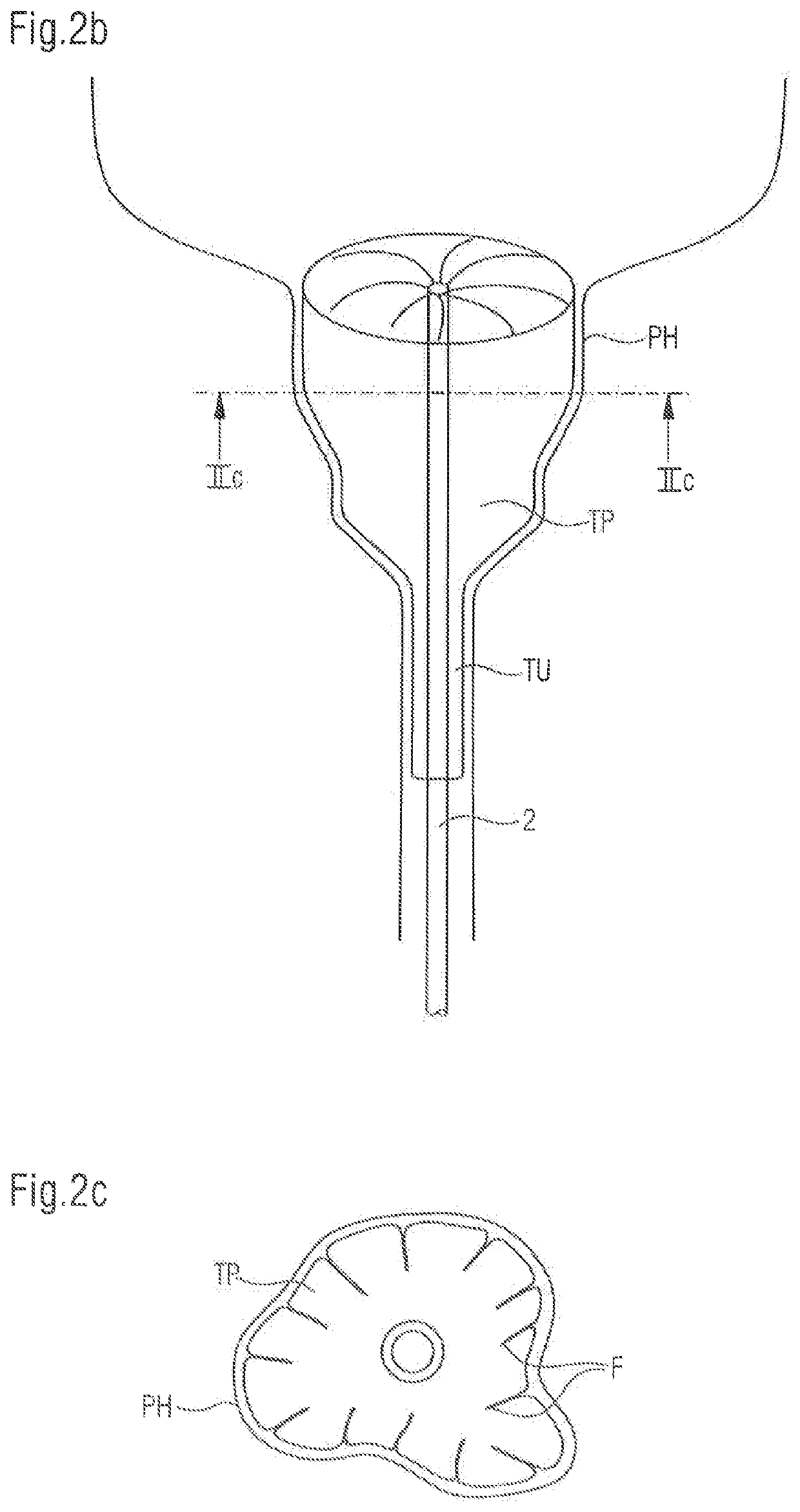 Bladder catheter for the minimally invasive discharge of urine