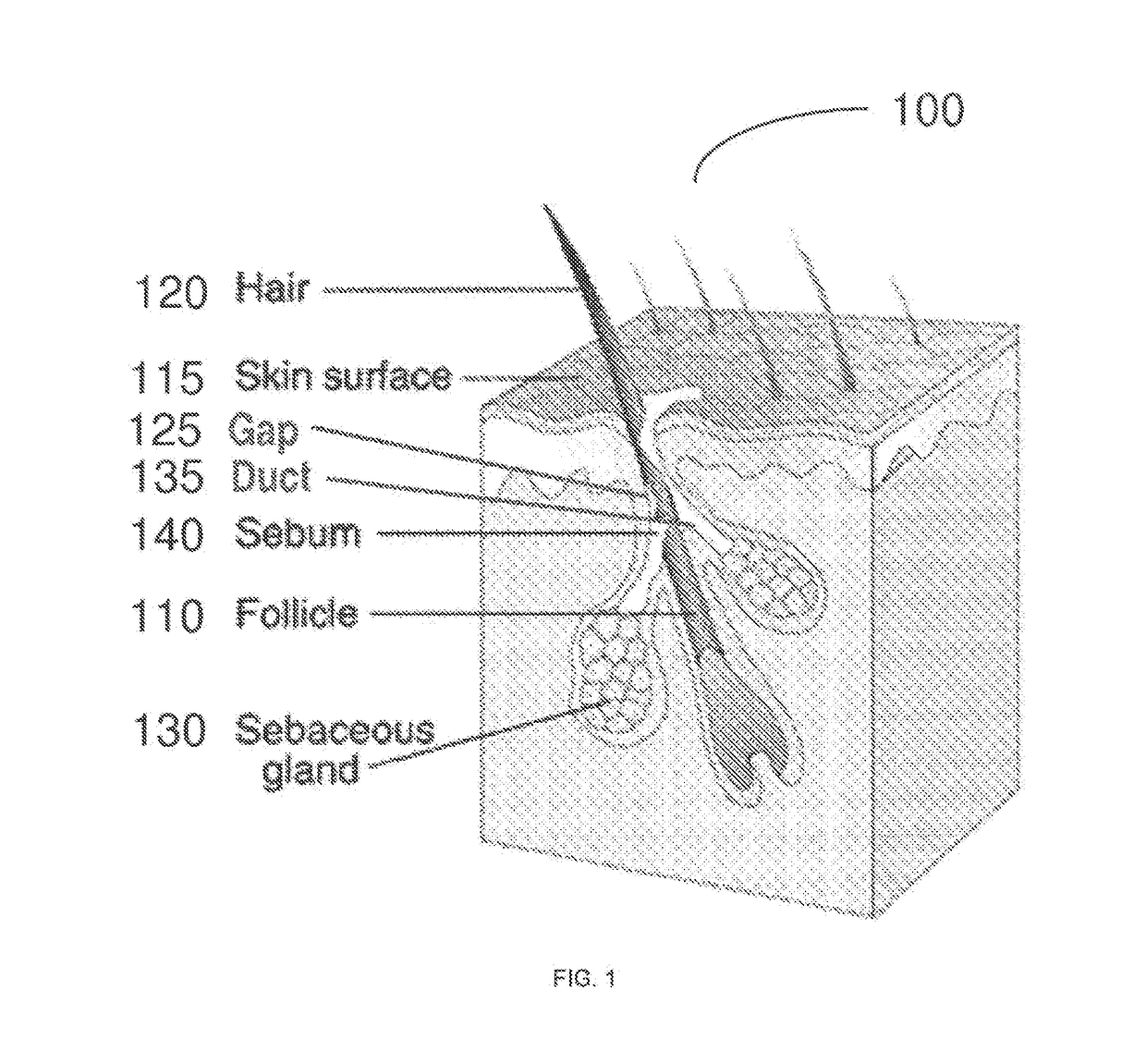 Methods, kits, and cooling devices for disrupting function of one or more sebaceous glands