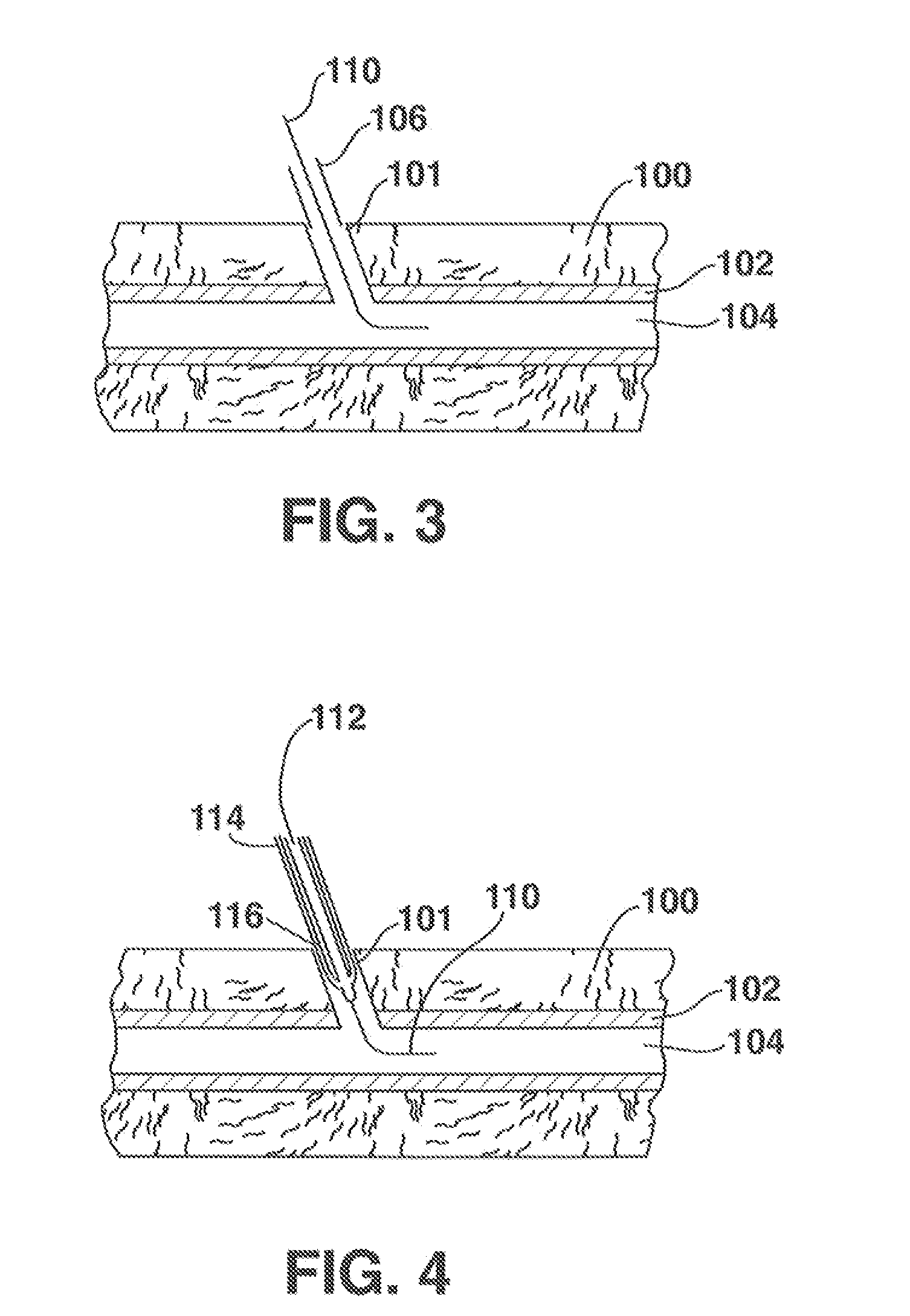 Low-Profile Vascular Closure Systems and Methods of Using Same