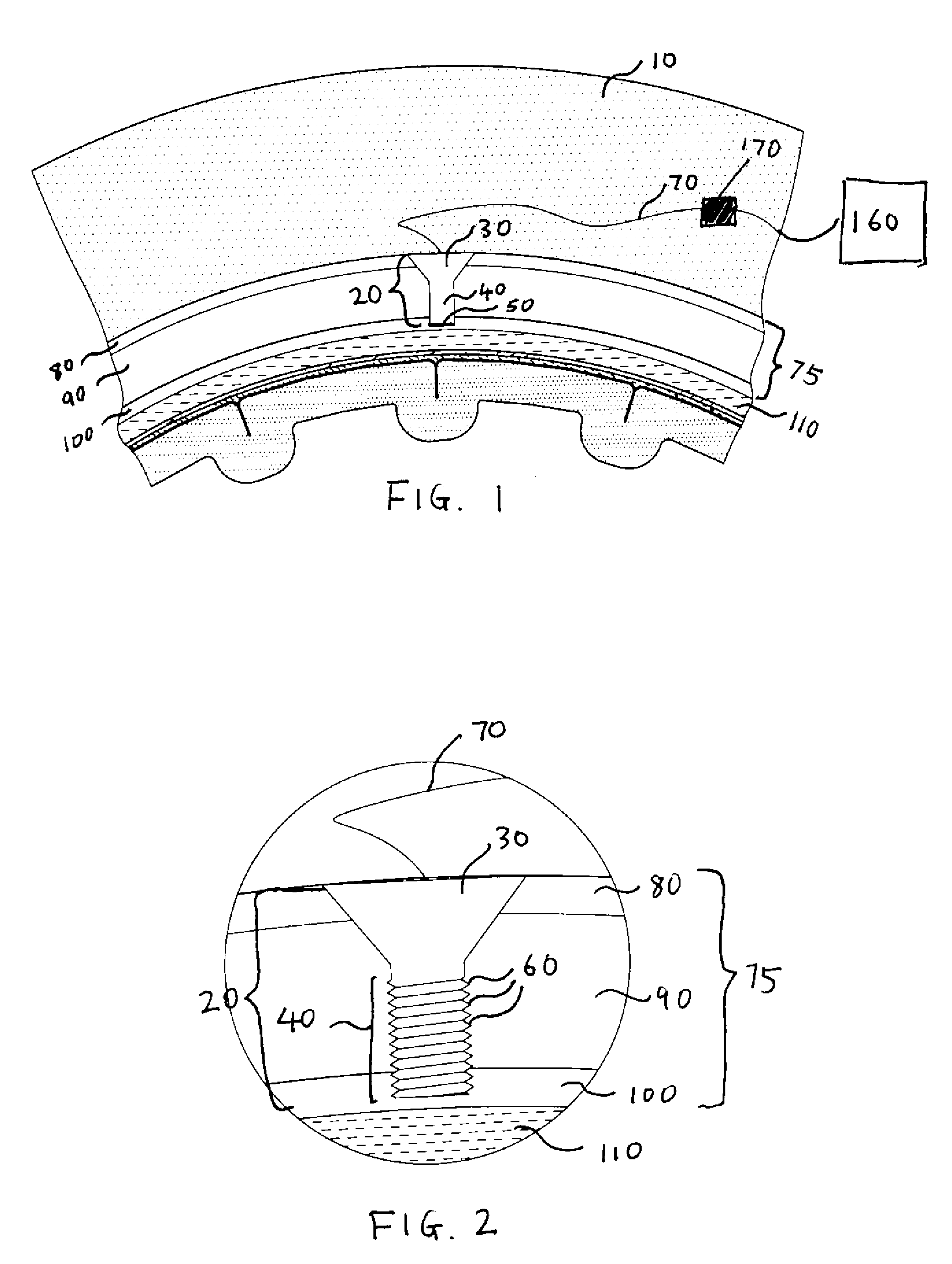 Methods and systems for using intracranial electrodes
