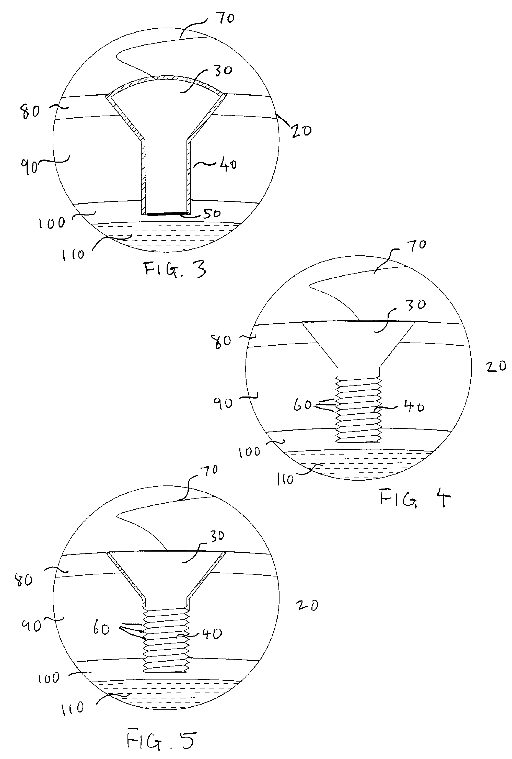 Methods and systems for using intracranial electrodes