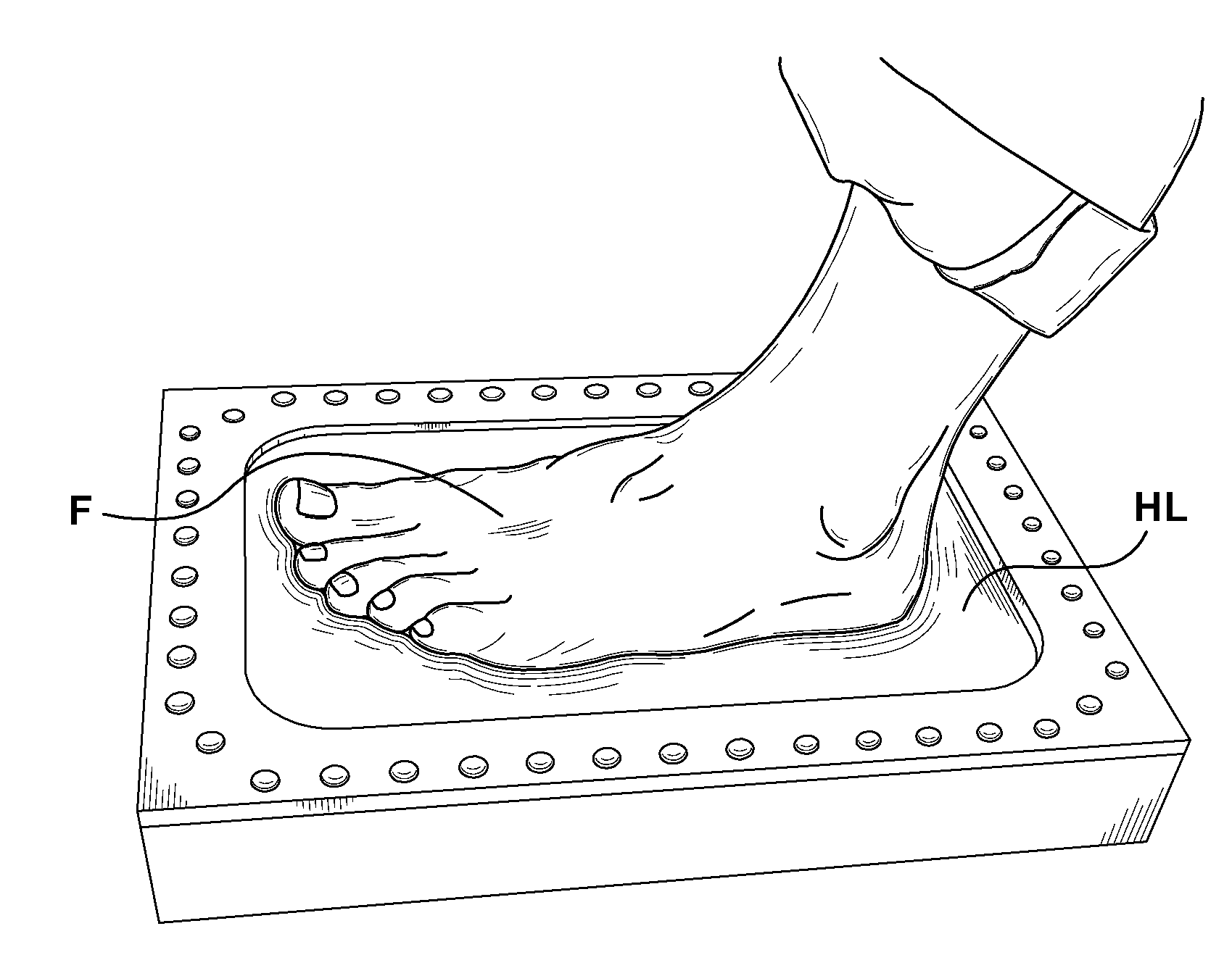 Method for Design and Manufacture of Insoles