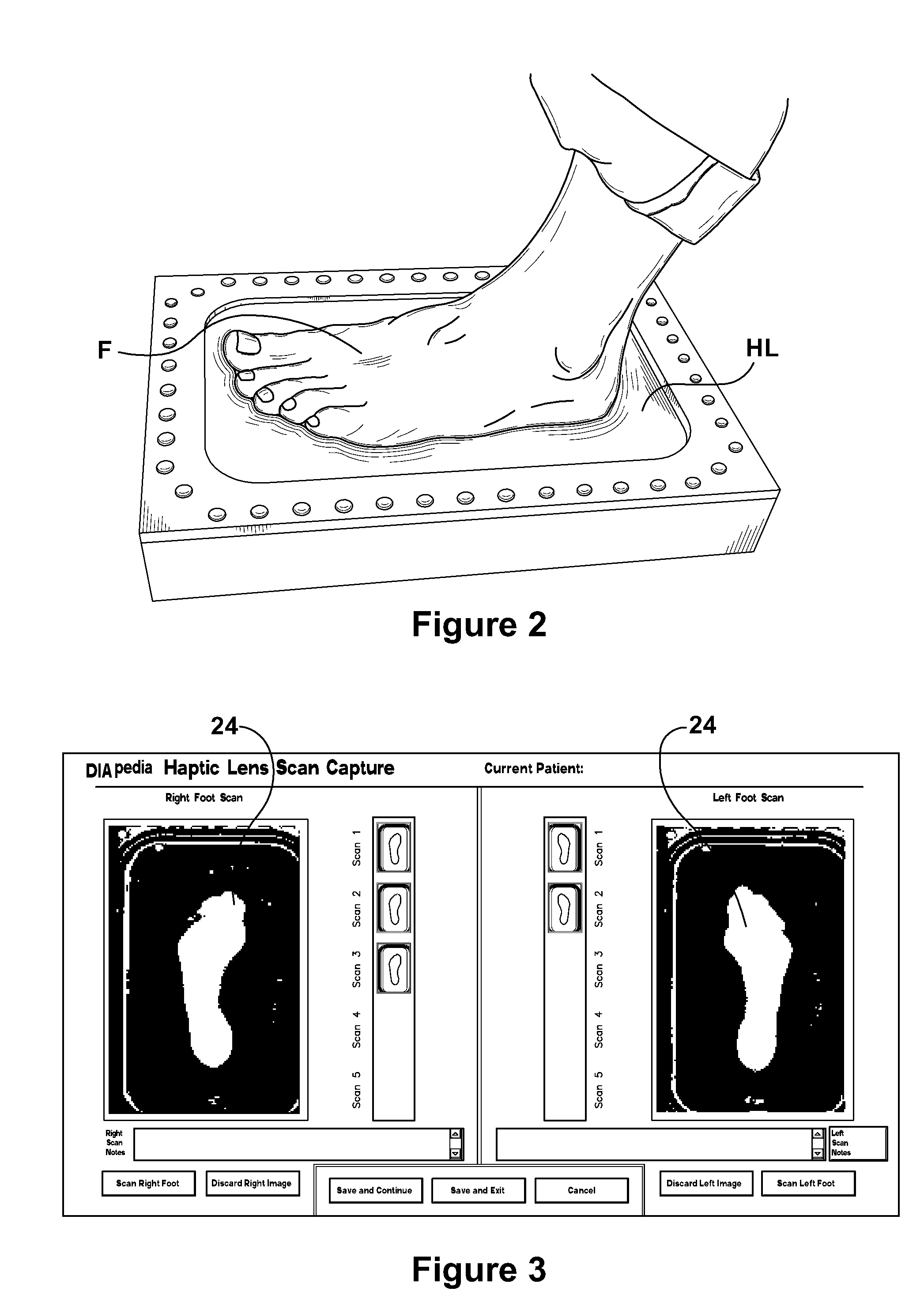Method for Design and Manufacture of Insoles