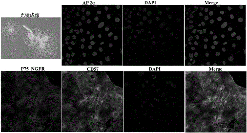 A directional differentiation induction method of human embryonic stem cells to obtain corneal endothelial cells