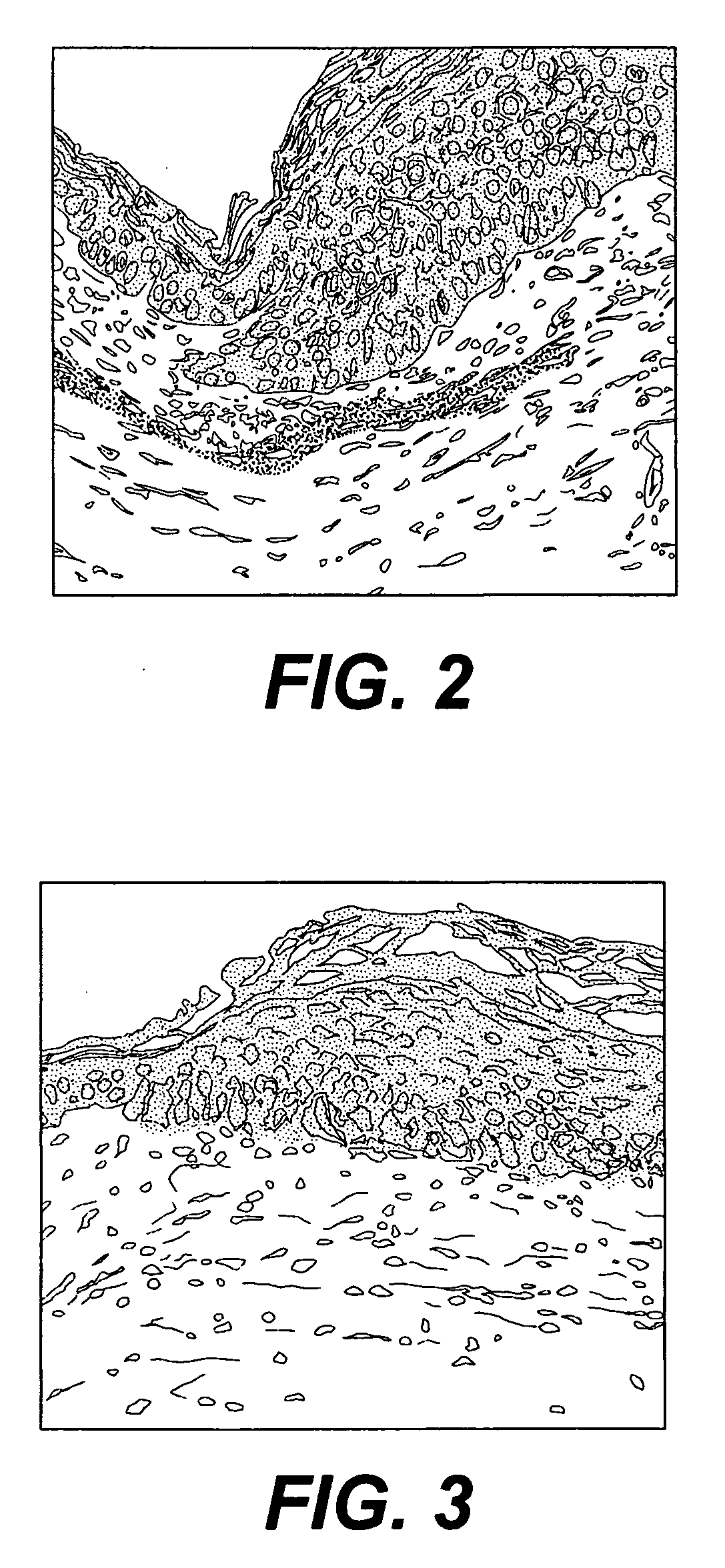 Pigmentable epidermis equivalent prepared from matrix cells and methods for the production thereof