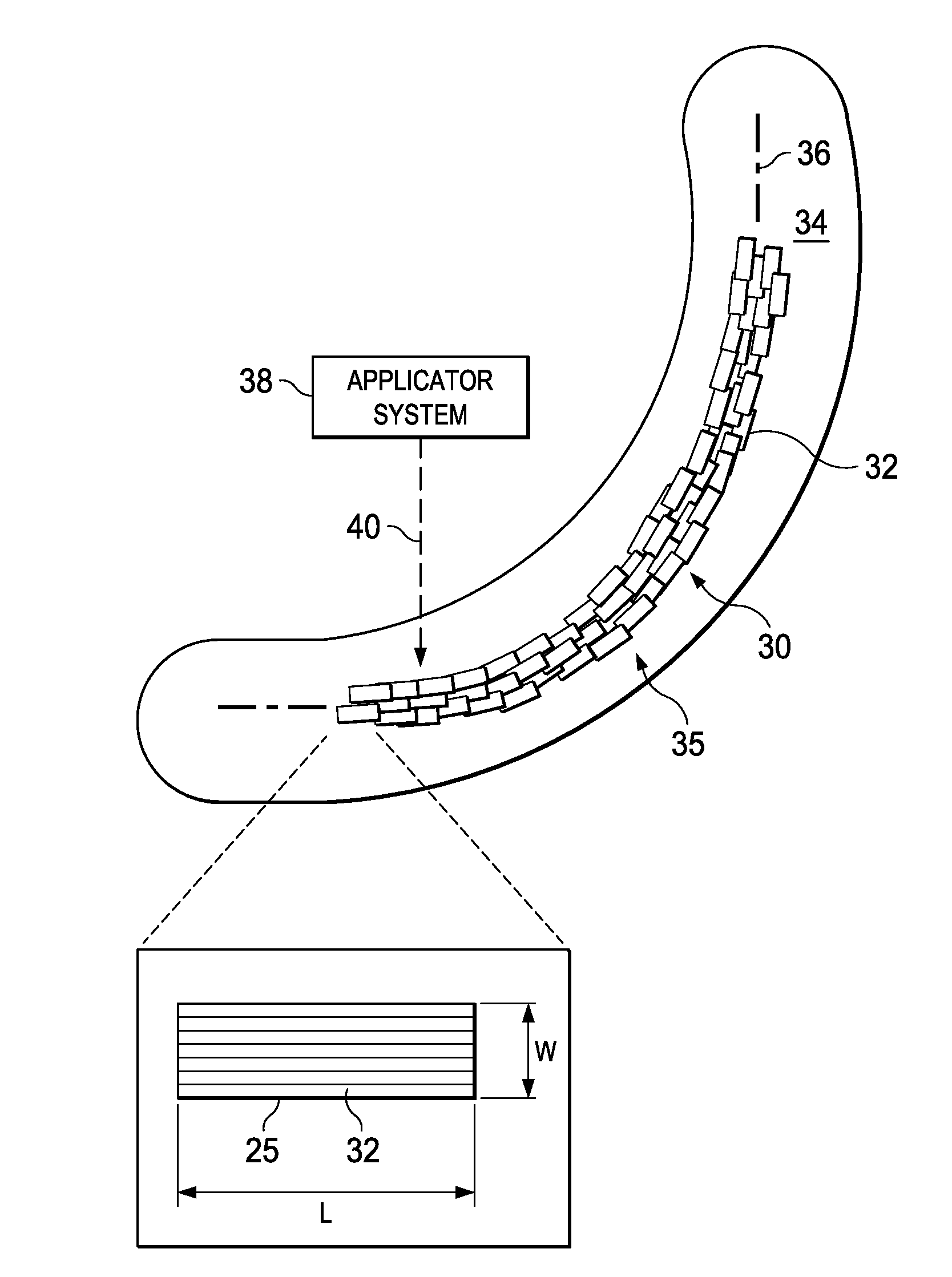 Forming Composite Features Using Steered Discontinuous Fiber Pre-Preg